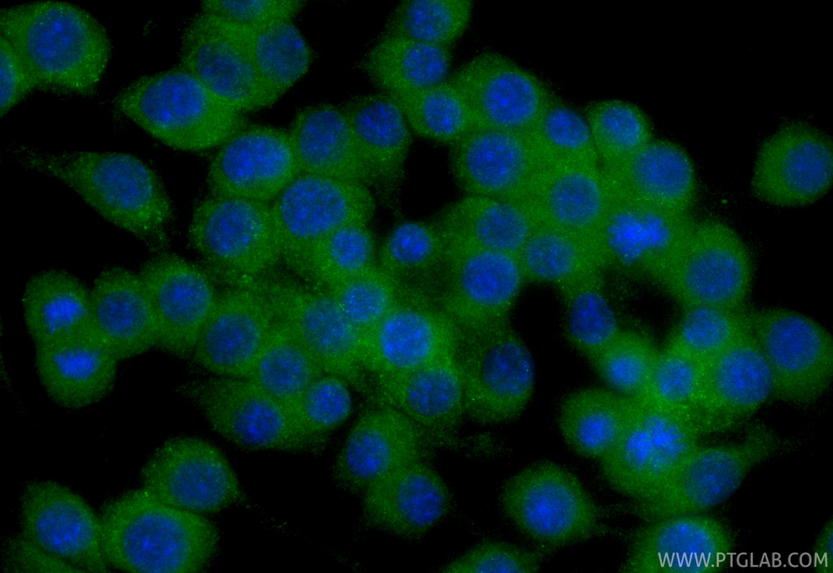 IF Staining of RAW 264.7 using CL488-26991 Immunofluorescence (IF) / fluorescent staining of RAW 264.7 cells using CoraLite® Plus 488-conjugated Lipocalin-2/NGAL Pol (CL488-26991)