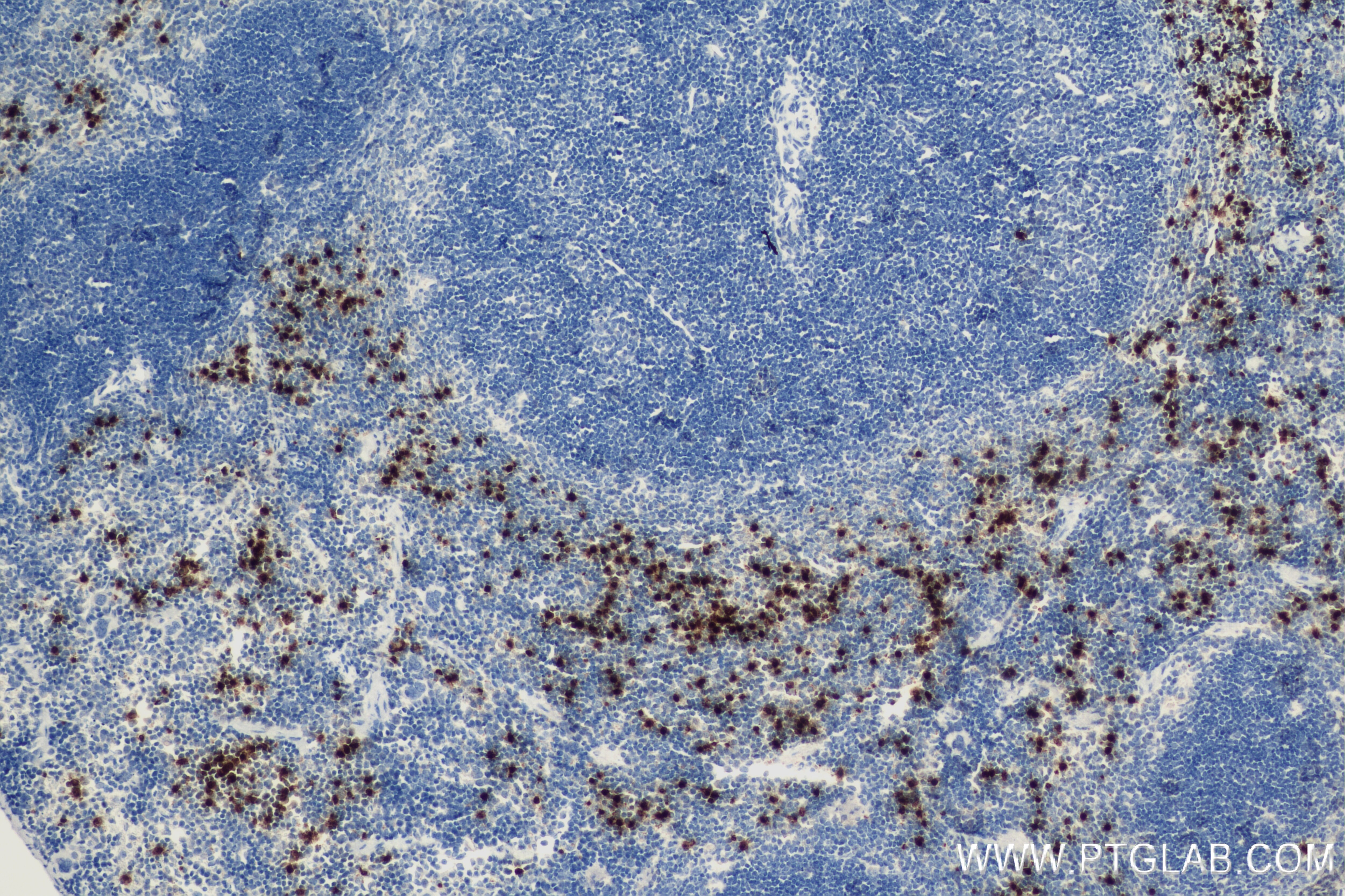 Immunohistochemistry (IHC) staining of mouse spleen tissue using Lipocalin-2/Ngal Recombinant antibody (83853-2-RR)