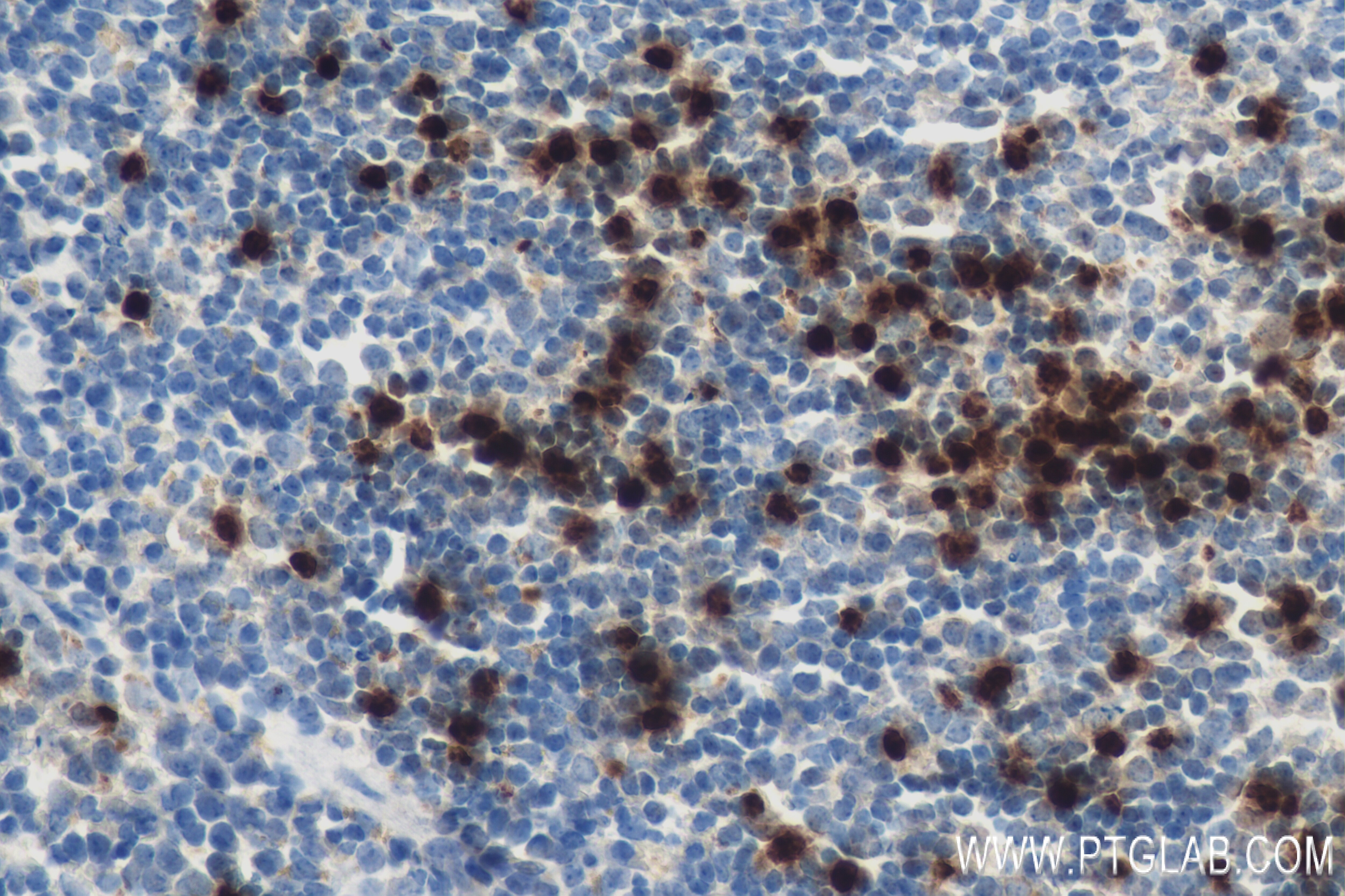 Immunohistochemistry (IHC) staining of mouse spleen tissue using Lipocalin-2/Ngal Recombinant antibody (83853-2-RR)