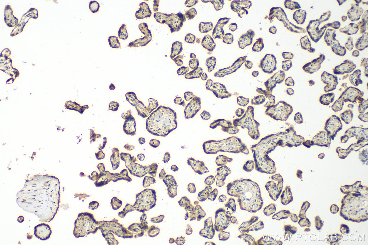 Lipoprotein(a)