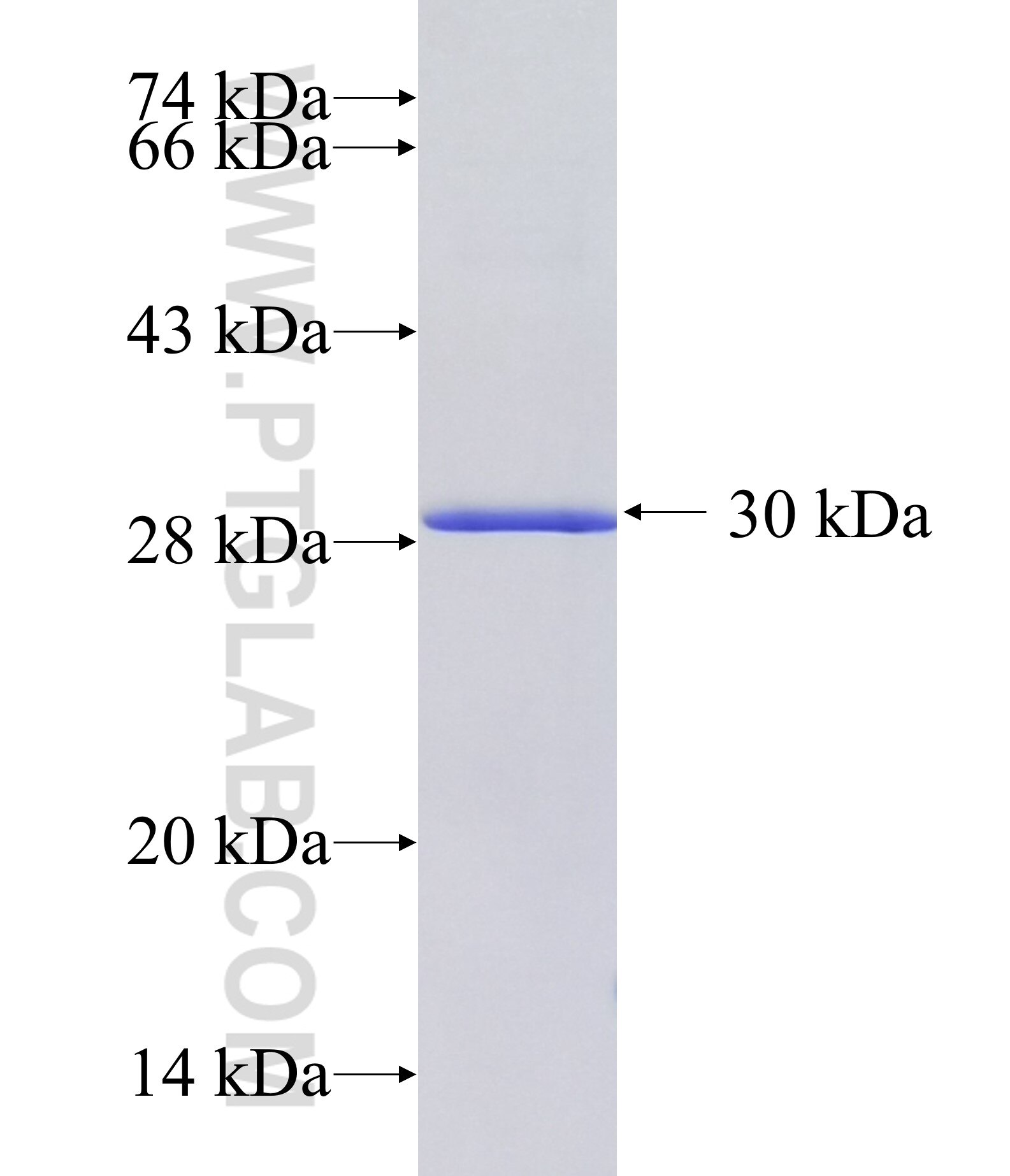 Lipoprotein(a) fusion protein Ag32907 SDS-PAGE