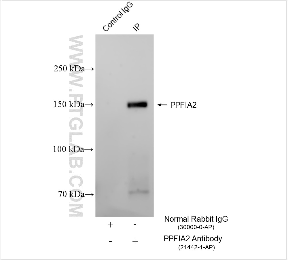 Liprin Alpha 2