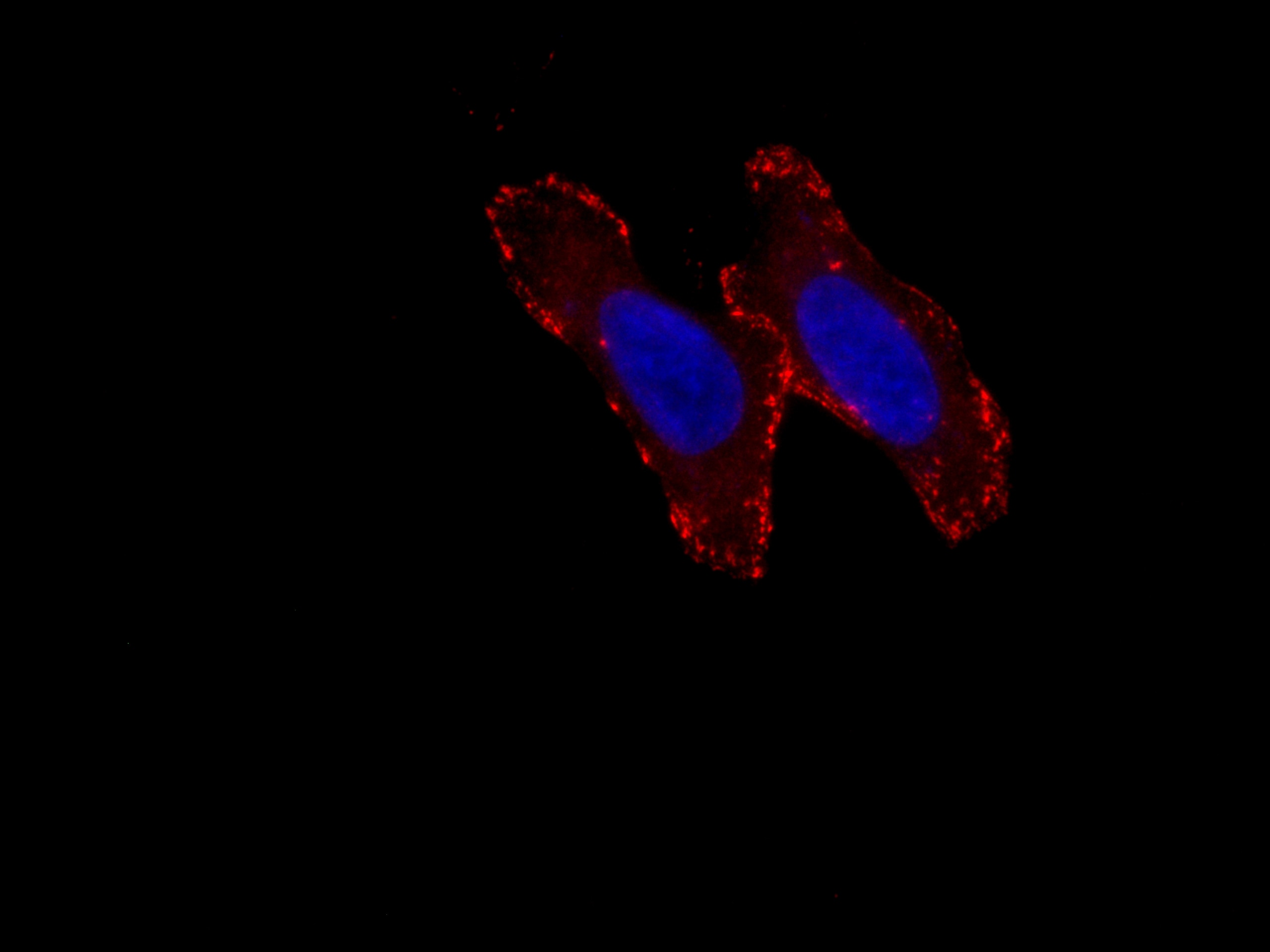 Immunofluorescence (IF) / fluorescent staining of HepG2 cells using CoraLite®594-conjugated Liprin Alpha 1 Polyclonal  (CL594-14175)