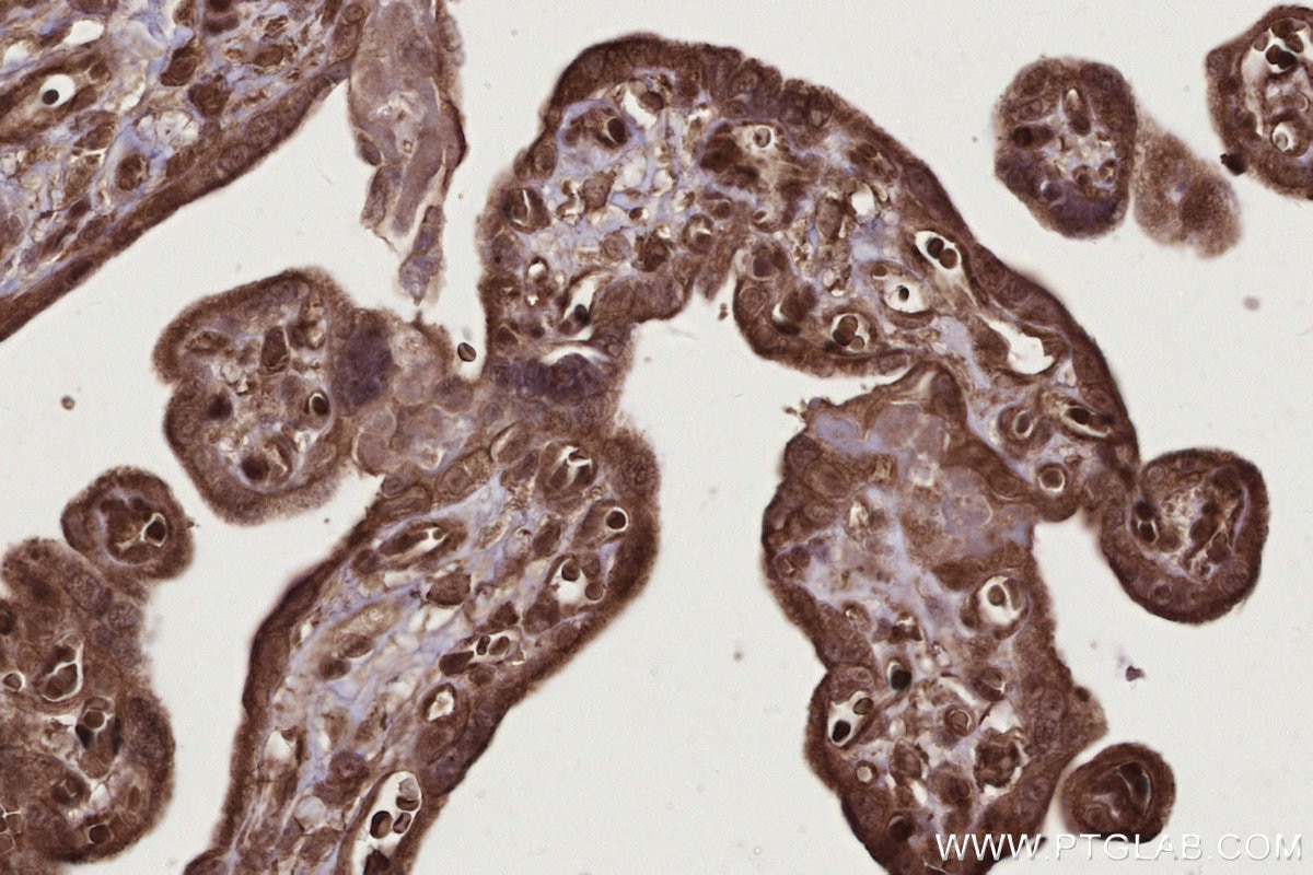Immunohistochemistry (IHC) staining of human placenta tissue using Livin Polyclonal antibody (27543-1-AP)