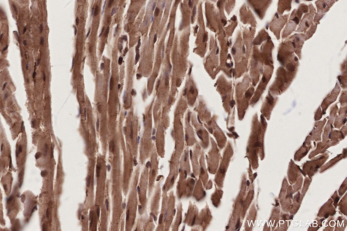 Immunohistochemistry (IHC) staining of mouse heart tissue using Livin Polyclonal antibody (27543-1-AP)