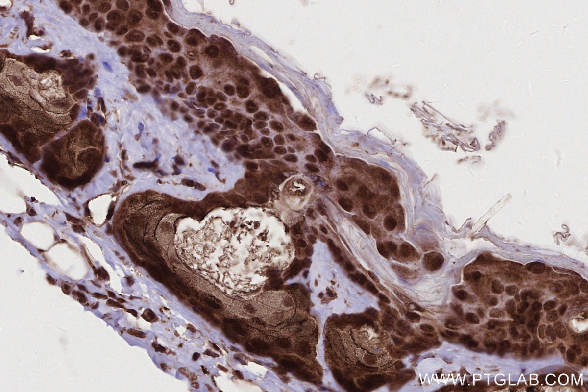Immunohistochemistry (IHC) staining of mouse skin tissue using Livin Polyclonal antibody (27543-1-AP)