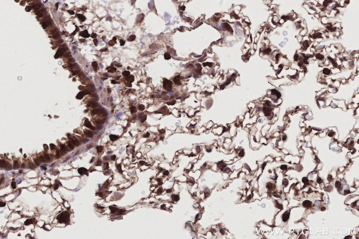 Immunohistochemistry (IHC) staining of rat lung tissue using Livin Polyclonal antibody (27543-1-AP)