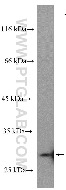Western Blot (WB) analysis of A431 cells using Livin Polyclonal antibody (27543-1-AP)