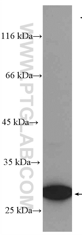 Western Blot (WB) analysis of A375 cells using Livin Polyclonal antibody (27543-1-AP)