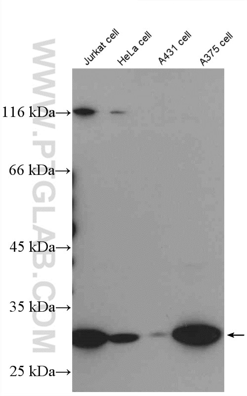 Western Blot (WB) analysis of various lysates using Livin Polyclonal antibody (27543-1-AP)