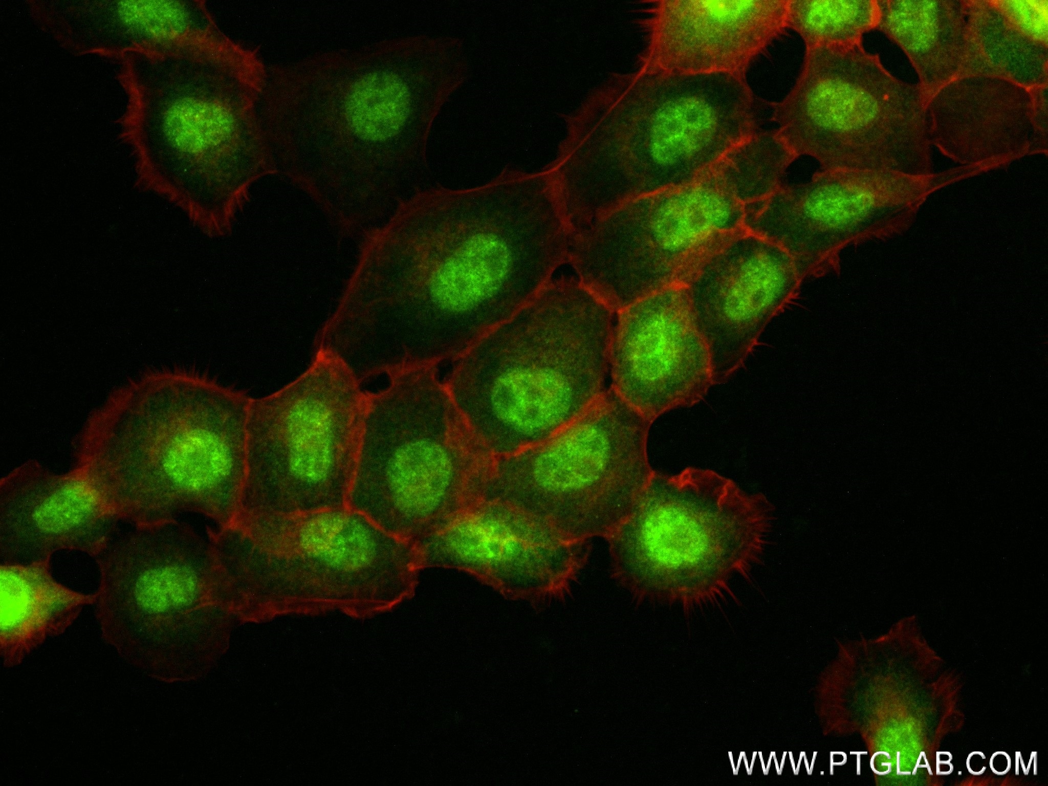 Immunofluorescence (IF) / fluorescent staining of A431 cells using Loricrin Recombinant antibody (83865-1-RR)