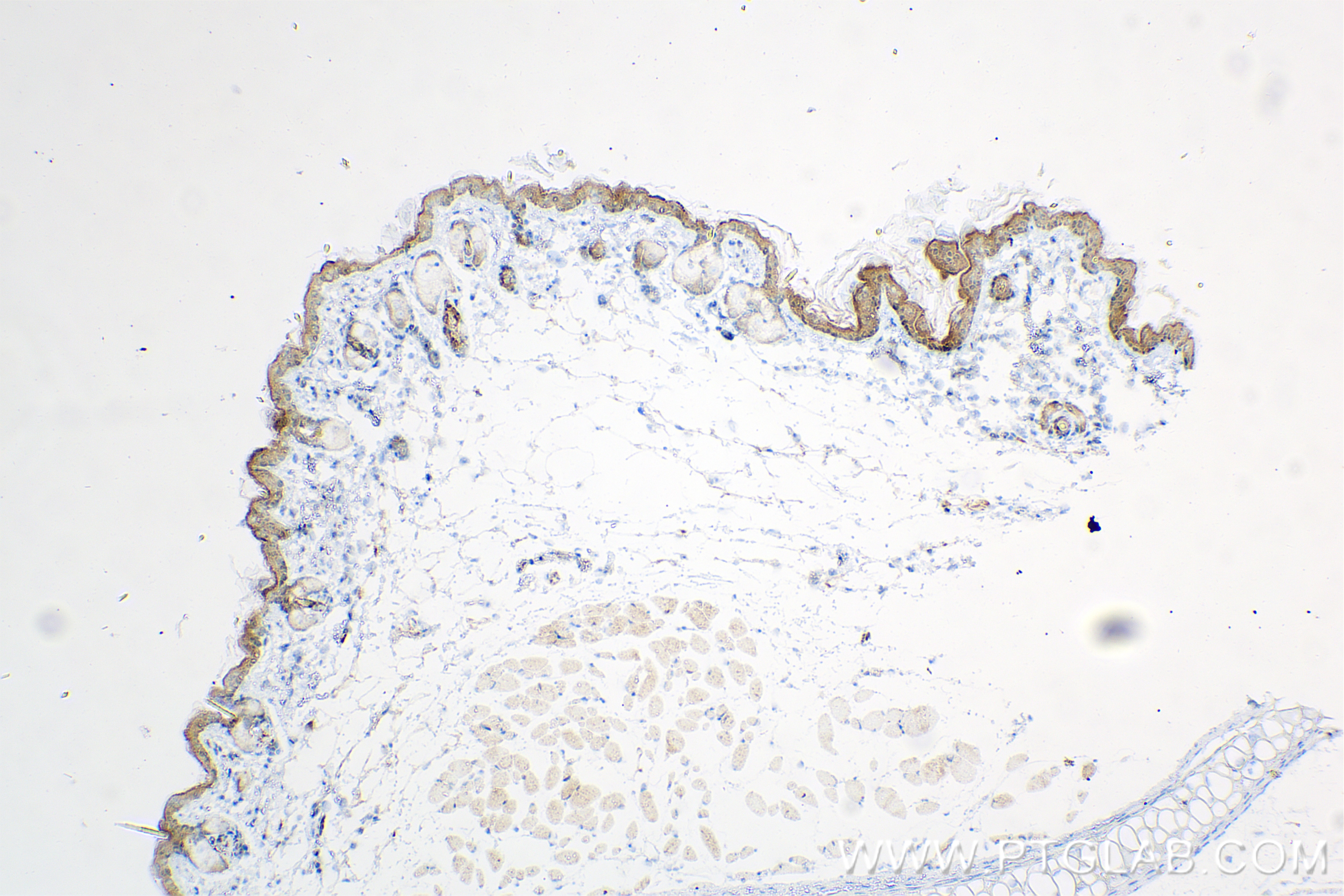 Immunohistochemistry (IHC) staining of mouse skin tissue using Loricrin Recombinant antibody (83865-1-RR)