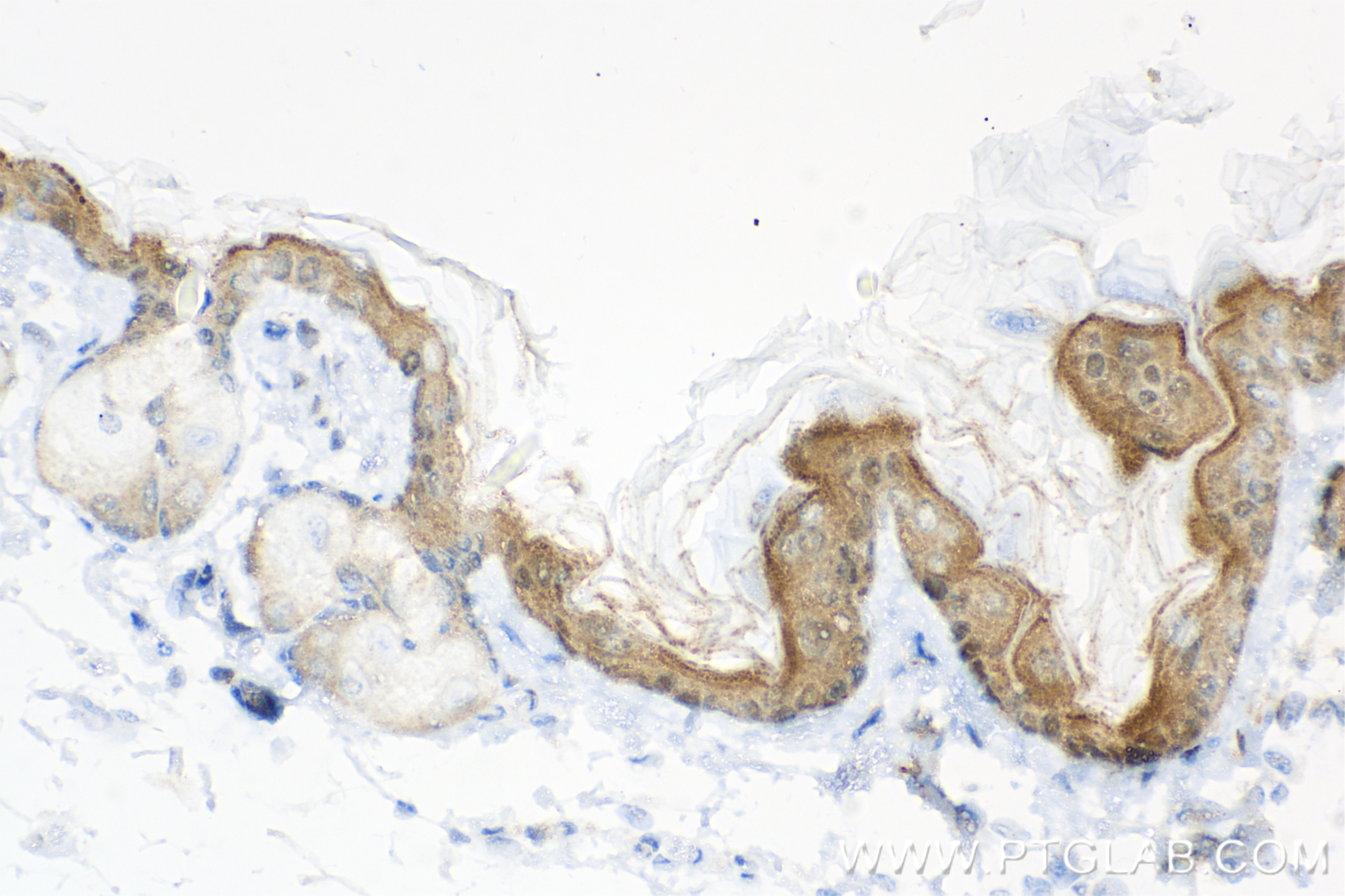 Immunohistochemistry (IHC) staining of mouse skin tissue using Loricrin Recombinant antibody (83865-1-RR)