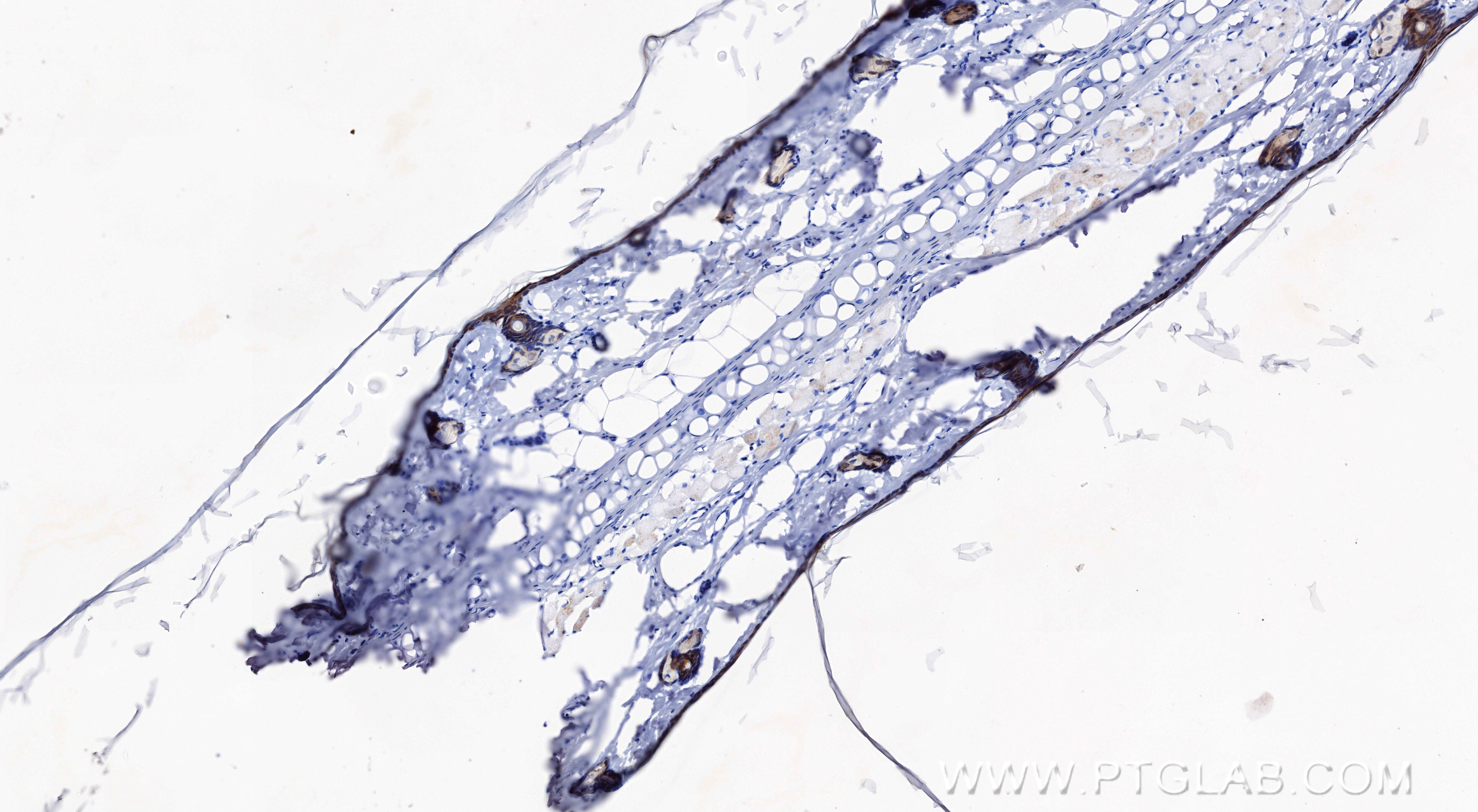 Immunohistochemical analysis of paraffin-embedded rat skin tissue slide using 83865-1-RR (Loricrin antibody) at dilution of 1:500 (under 10x lens). Heat mediated antigen retrieval with Tris-EDTA buffer (pH 9.0). Immunohistochemistry (IHC) staining of rat skin tissue using Loricrin Recombinant monoclonal antibody (83865-1-RR)