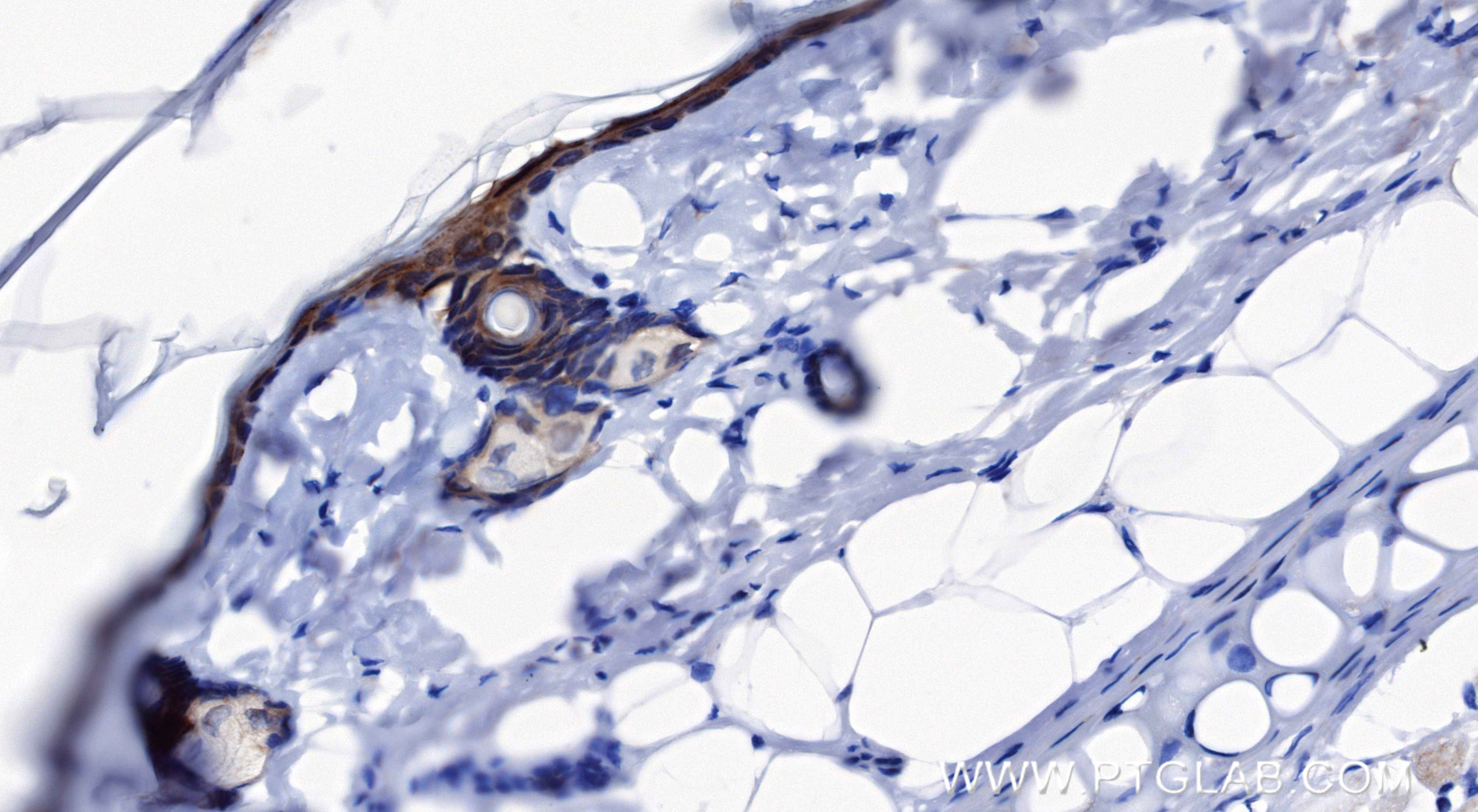 Immunohistochemical analysis of paraffin-embedded rat skin tissue slide using 83865-1-RR (Loricrin antibody) at dilution of 1:500 (under 40x lens). Heat mediated antigen retrieval with Tris-EDTA buffer (pH 9.0). Immunohistochemistry (IHC) staining of rat skin tissue using Loricrin Recombinant monoclonal antibody (83865-1-RR)