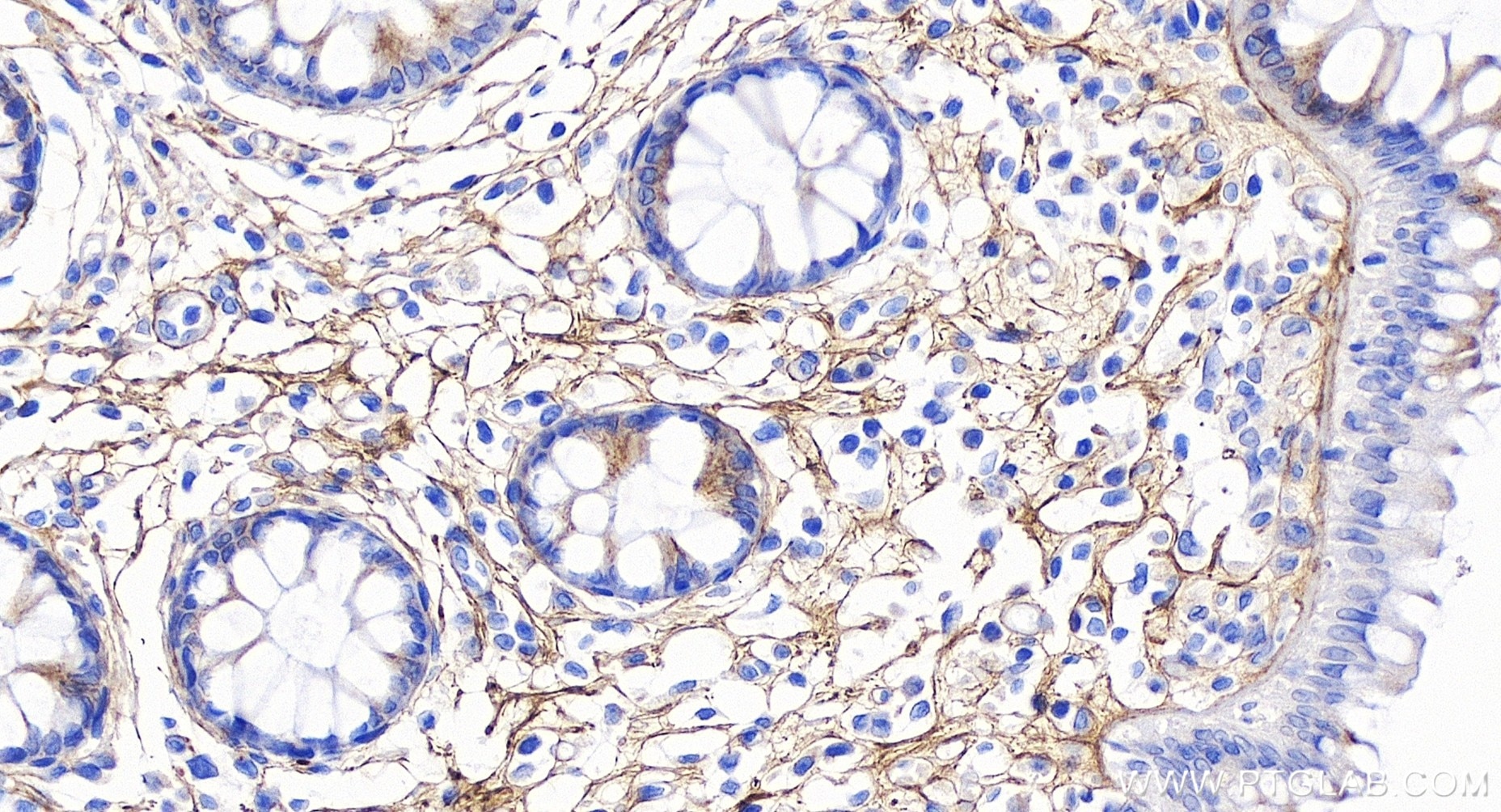 Immunohistochemistry (IHC) staining of human colon tissue using Lumican Recombinant antibody (85343-1-RR)