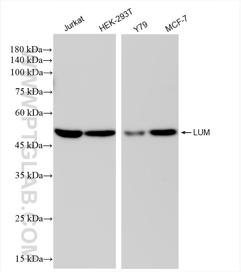 Western Blot (WB) analysis of various lysates using Lumican Recombinant antibody (85343-1-RR)