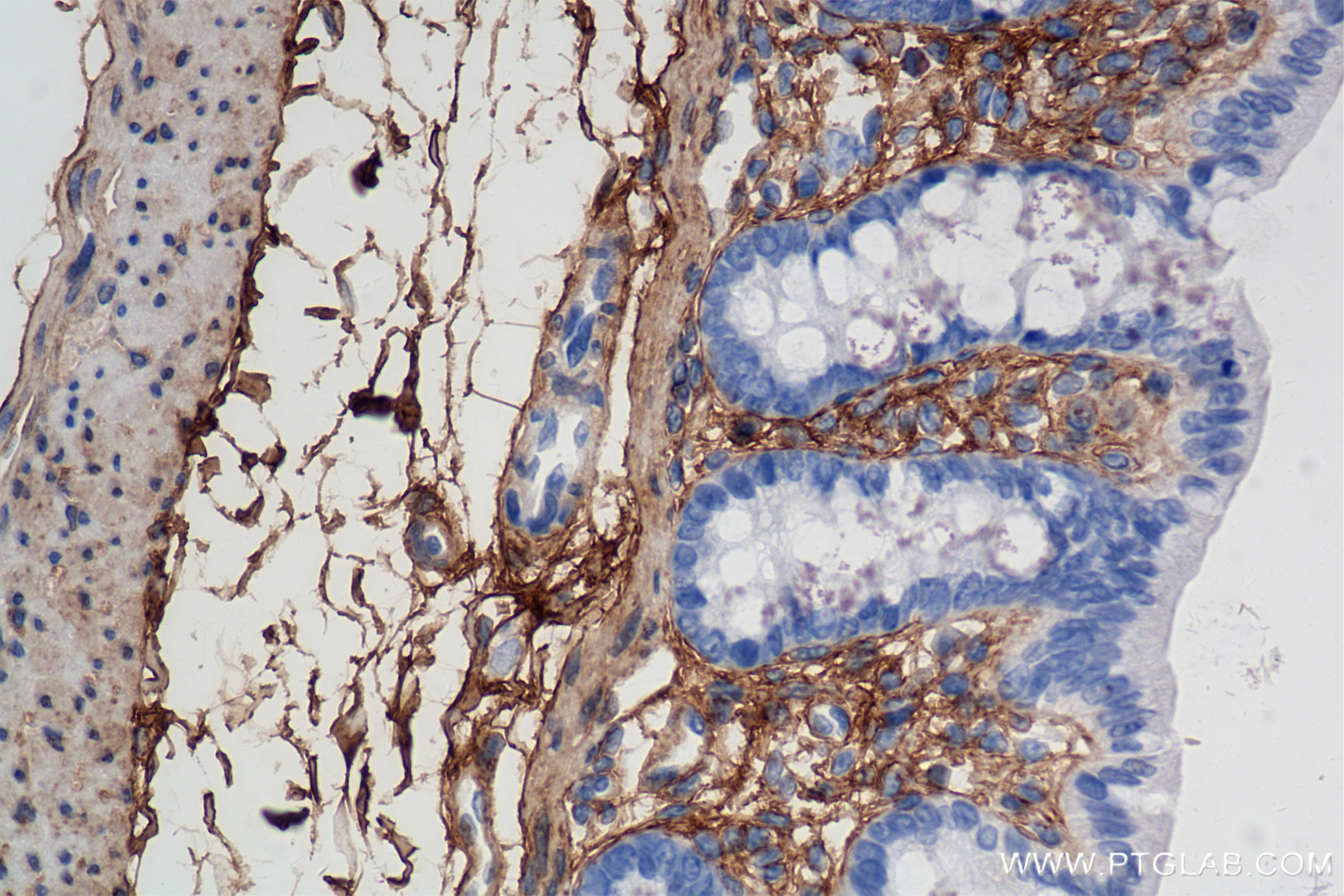 Immunohistochemistry (IHC) staining of rat colon tissue using Lumican Recombinant antibody (85629-1-RR)