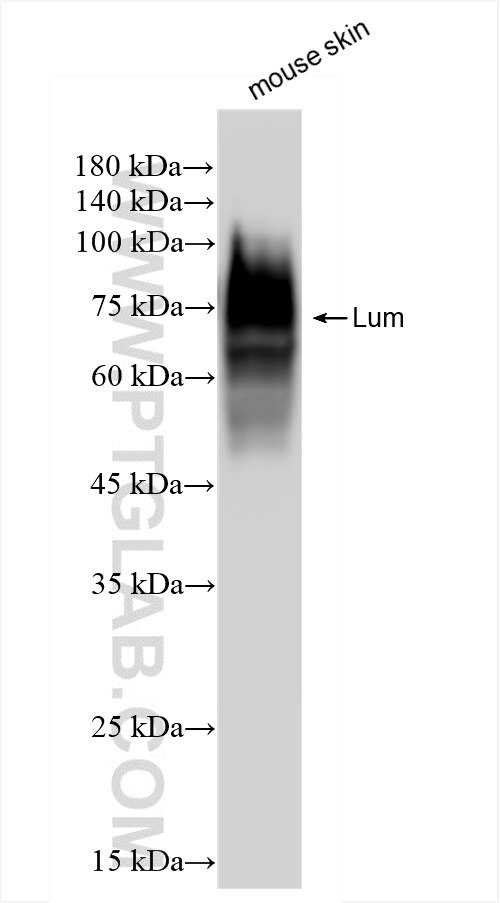 Western Blot (WB) analysis of mouse skin tissue using Lumican Recombinant antibody (86082-3-RR)
