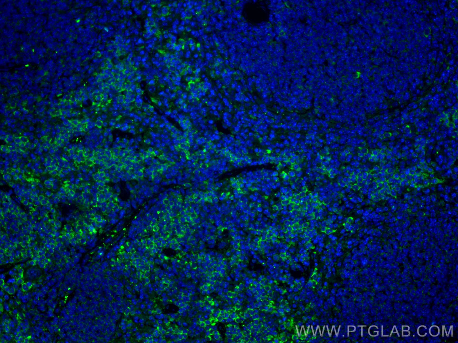 Immunofluorescence (IF) / fluorescent staining of mouse spleen tissue using CoraLite® Plus 488-conjugated Lumican Polyclonal a (CL488-10677)