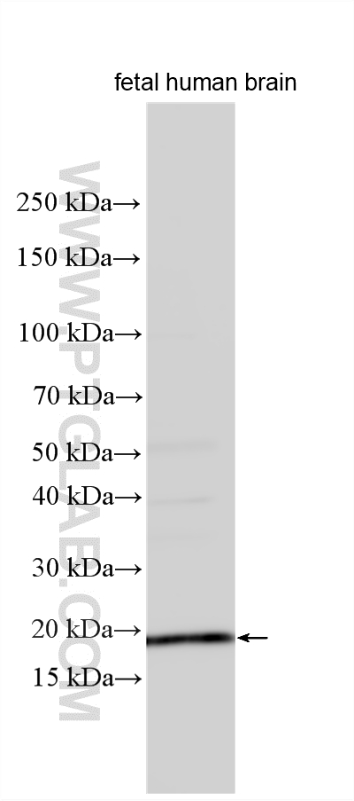 WB analysis using 33363-1-AP Western Blot (WB) analysis of various lysates using Luteinizing Hormone beta Polyclonal antibody (33363-1-AP)