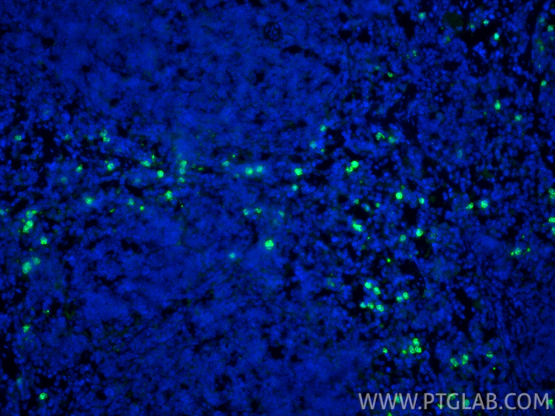 IF Staining of mouse spleen using 32346-1-AP Immunofluorescence (IF) / fluorescent staining of mouse spleen tissue using Ly-6G Polyclonal antibody (32346-1-AP)