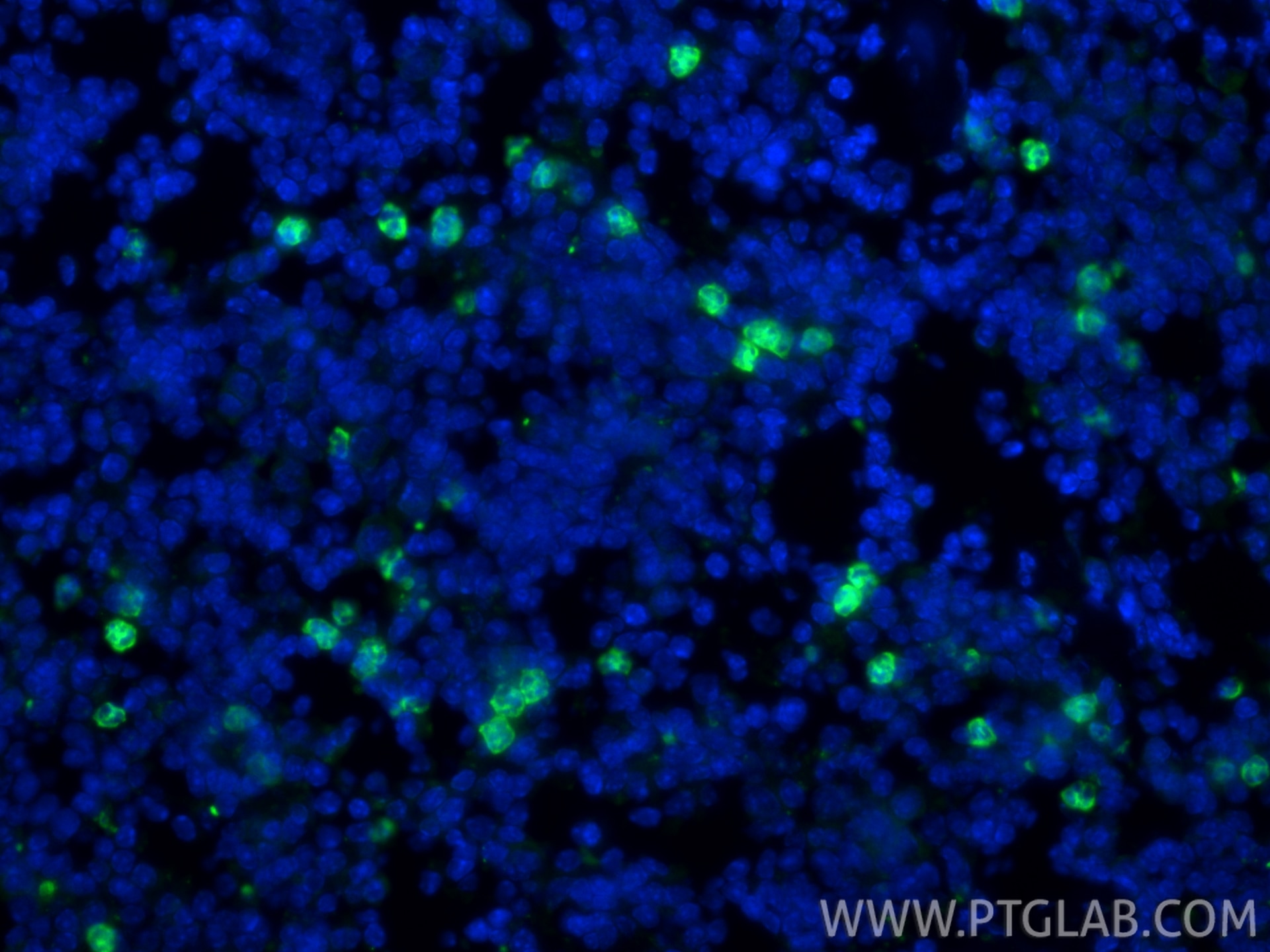 IF Staining of mouse spleen using 32346-1-AP Immunofluorescence (IF) / fluorescent staining of mouse spleen tissue using Ly-6G Polyclonal antibody (32346-1-AP)