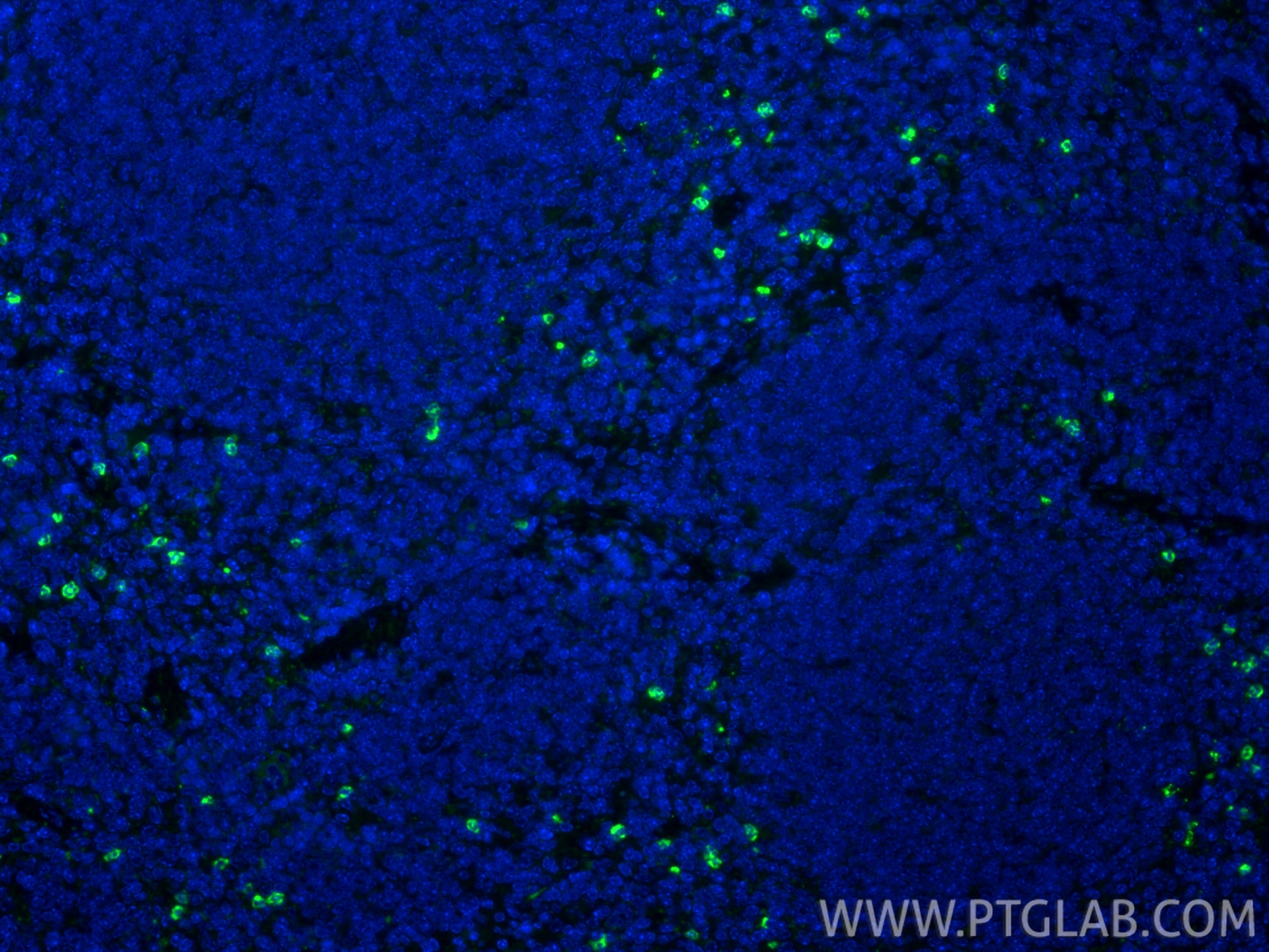 IF Staining of mouse spleen using 32346-1-AP Immunofluorescence (IF) / fluorescent staining of mouse spleen tissue using Ly-6G Polyclonal antibody (32346-1-AP)