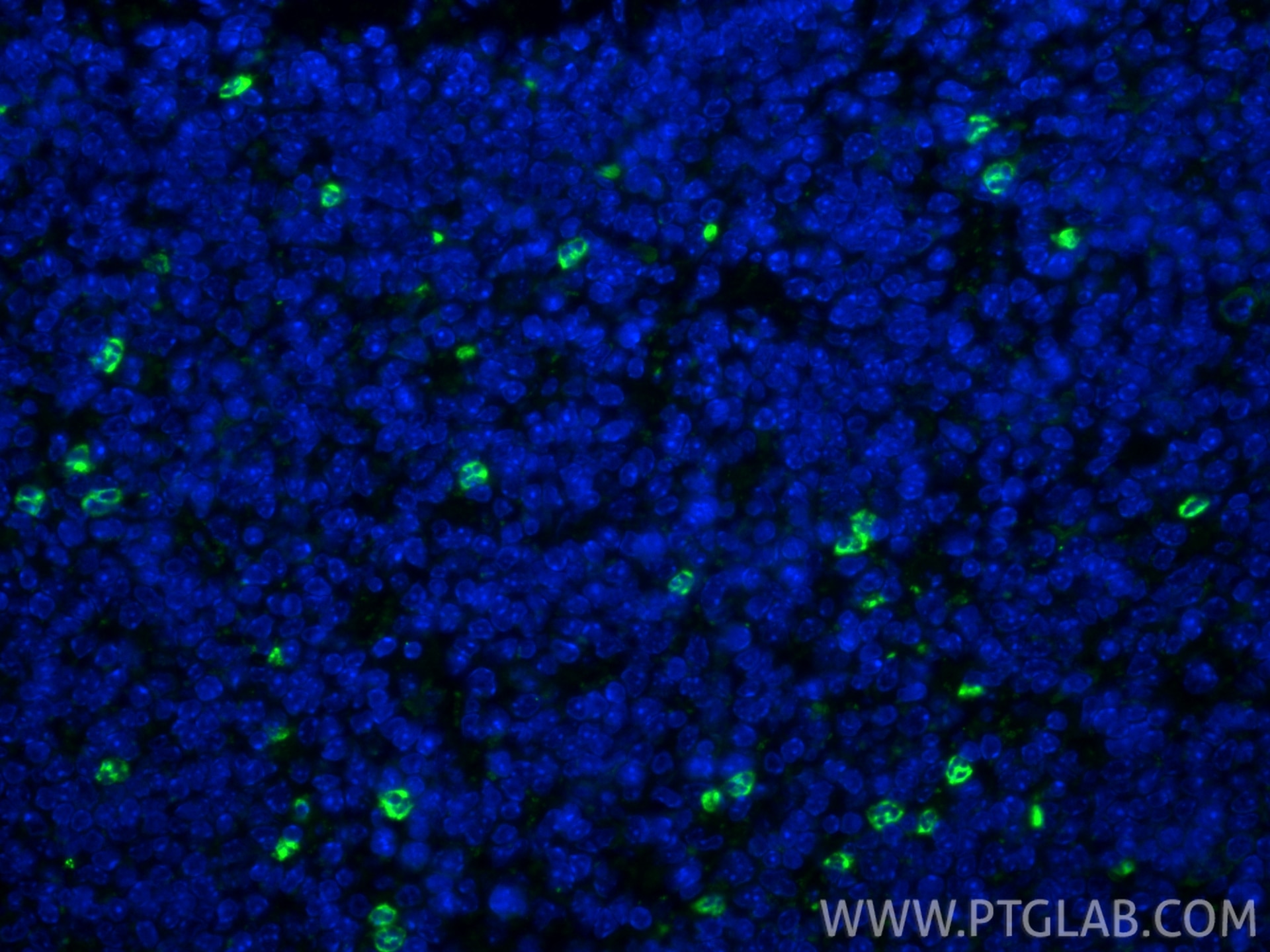 IF Staining of mouse spleen using 32346-1-AP Immunofluorescence (IF) / fluorescent staining of mouse spleen tissue using Ly-6G Polyclonal antibody (32346-1-AP)