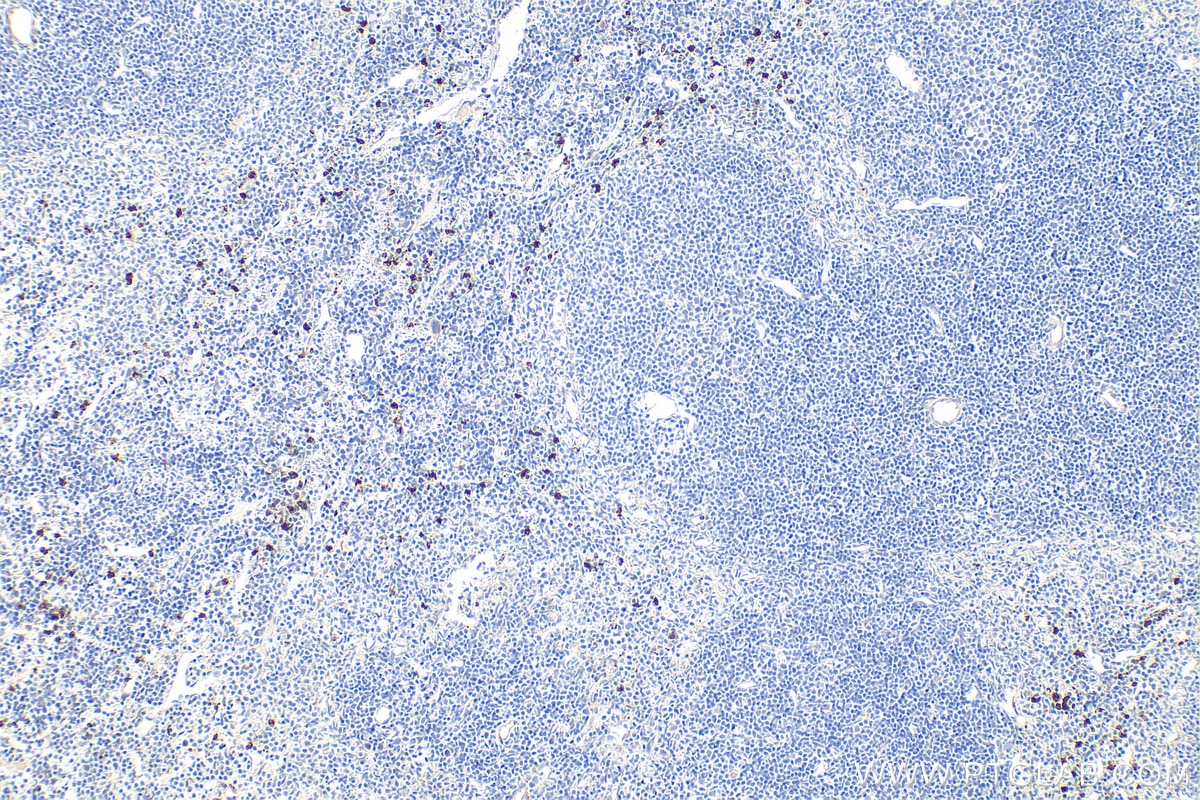 Immunohistochemistry (IHC) staining of mouse spleen tissue using Ly-6G Polyclonal antibody (32346-1-AP)