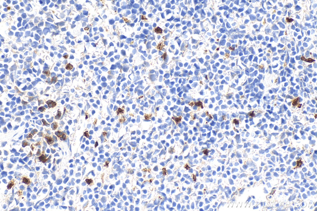 Immunohistochemistry (IHC) staining of mouse spleen tissue using Ly-6G Polyclonal antibody (32346-1-AP)