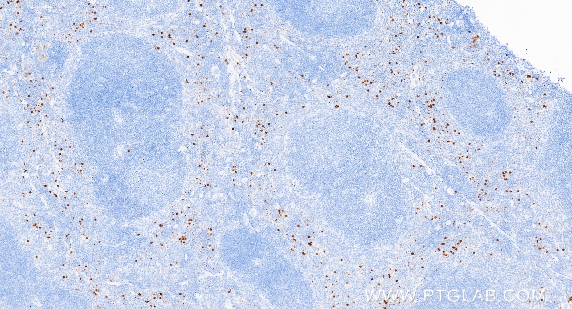 Immunohistochemistry (IHC) staining of mouse spleen tissue using Ly-6G Recombinant monoclonal antibody (84820-5-RR)