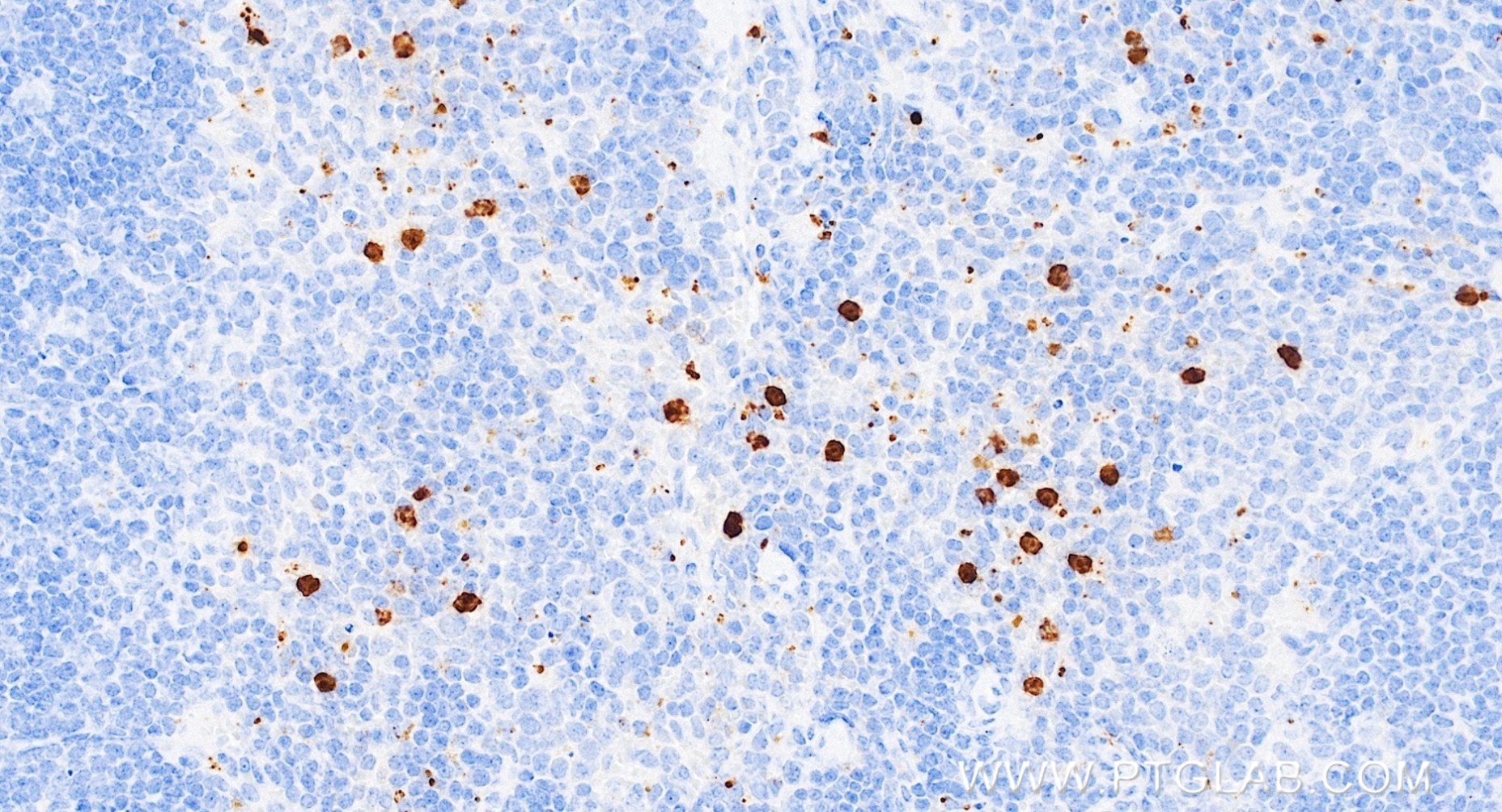 Immunohistochemistry (IHC) staining of mouse spleen tissue using Ly-6G Recombinant monoclonal antibody (84820-5-RR)