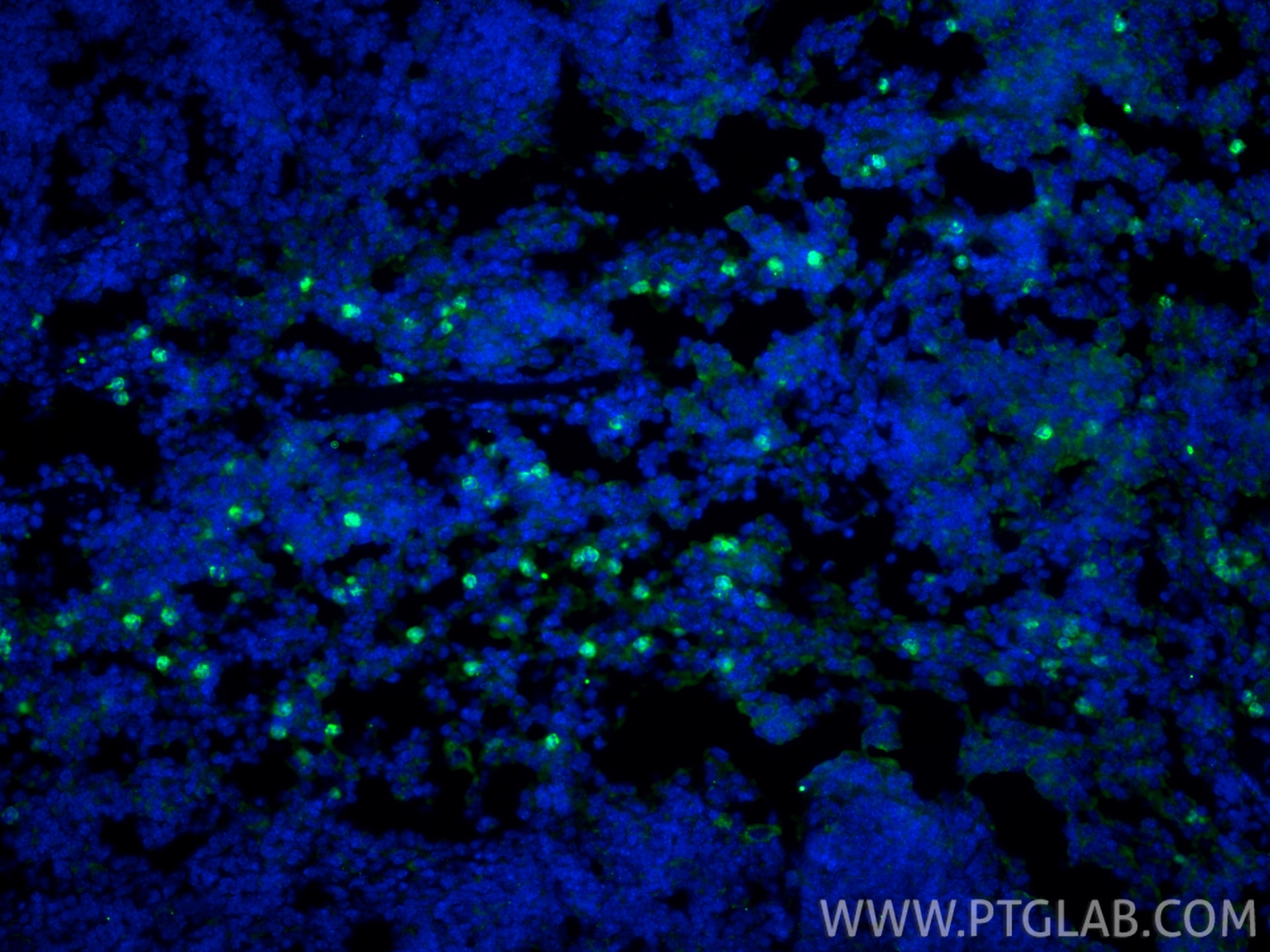 IF Staining of mouse spleen using 98284-1-RR Immunofluorescence (IF) / fluorescent staining of mouse spleen tissue using Anti-Mouse Ly-6G Rabbit Recombinant Antibody (98284-1-RR)