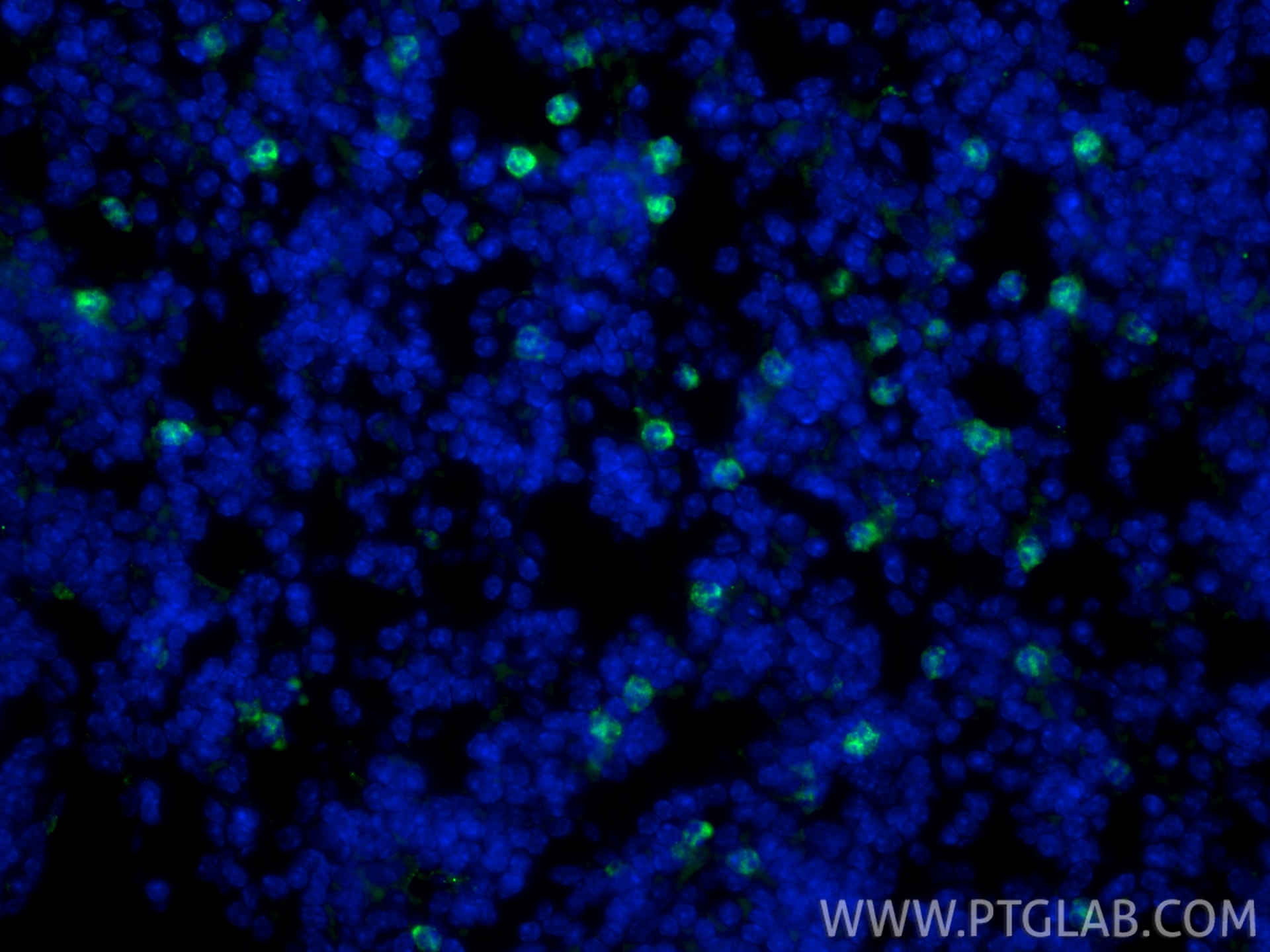 IF Staining of mouse spleen using 98284-1-RR Immunofluorescence (IF) / fluorescent staining of mouse spleen tissue using Anti-Mouse Ly-6G Rabbit Recombinant Antibody (98284-1-RR)