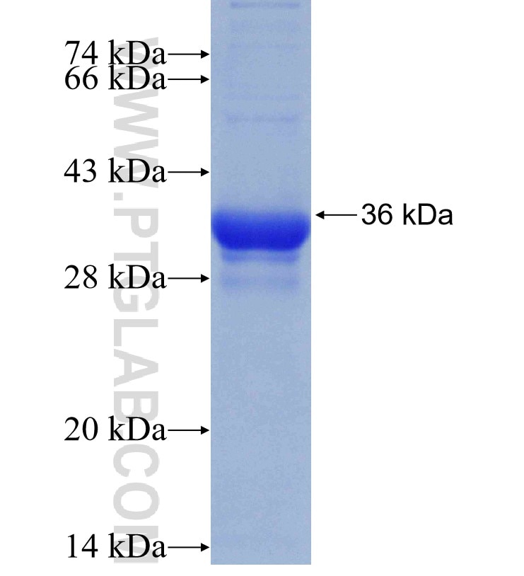 Ly6a fusion protein Ag31039 SDS-PAGE