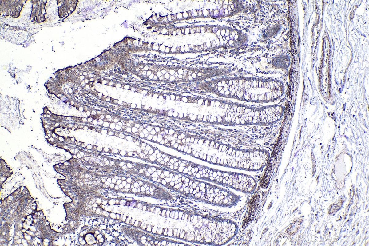 Immunohistochemistry (IHC) staining of human colon tissue using Lysozyme Monoclonal antibody (66456-1-Ig)