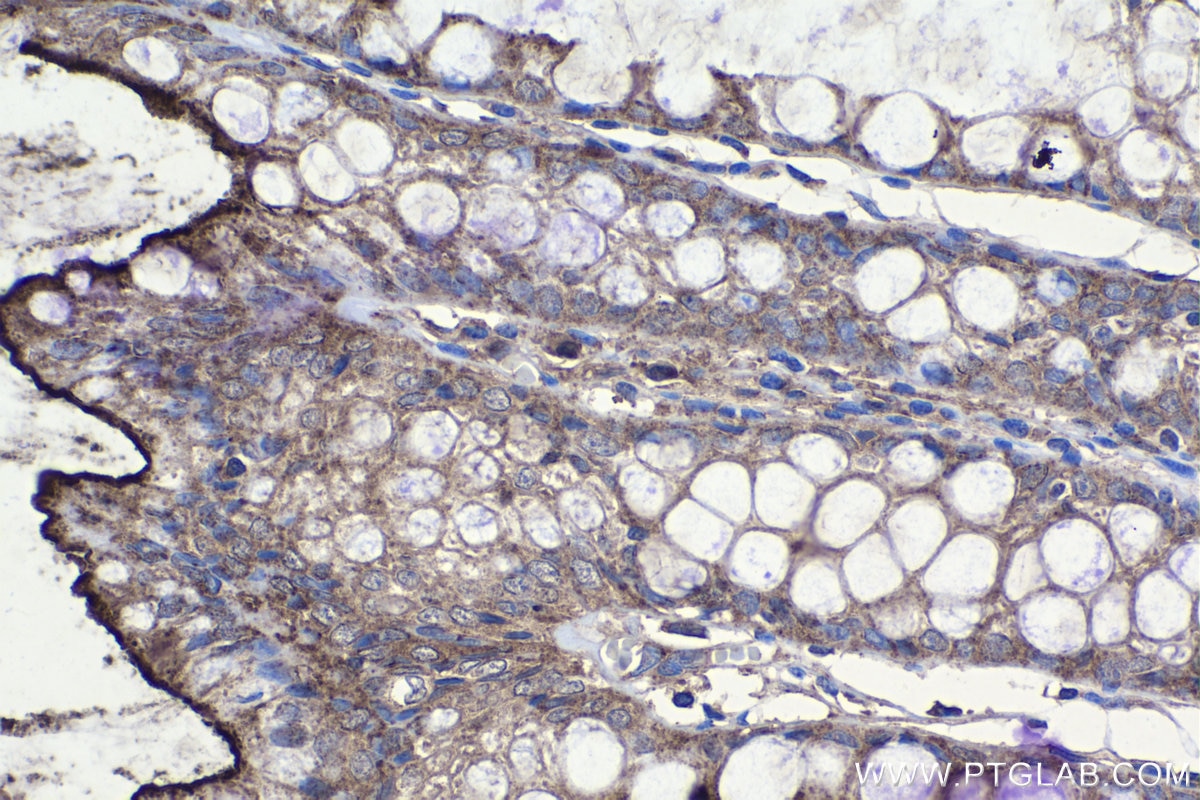 Immunohistochemistry (IHC) staining of human colon tissue using Lysozyme Monoclonal antibody (66456-1-Ig)