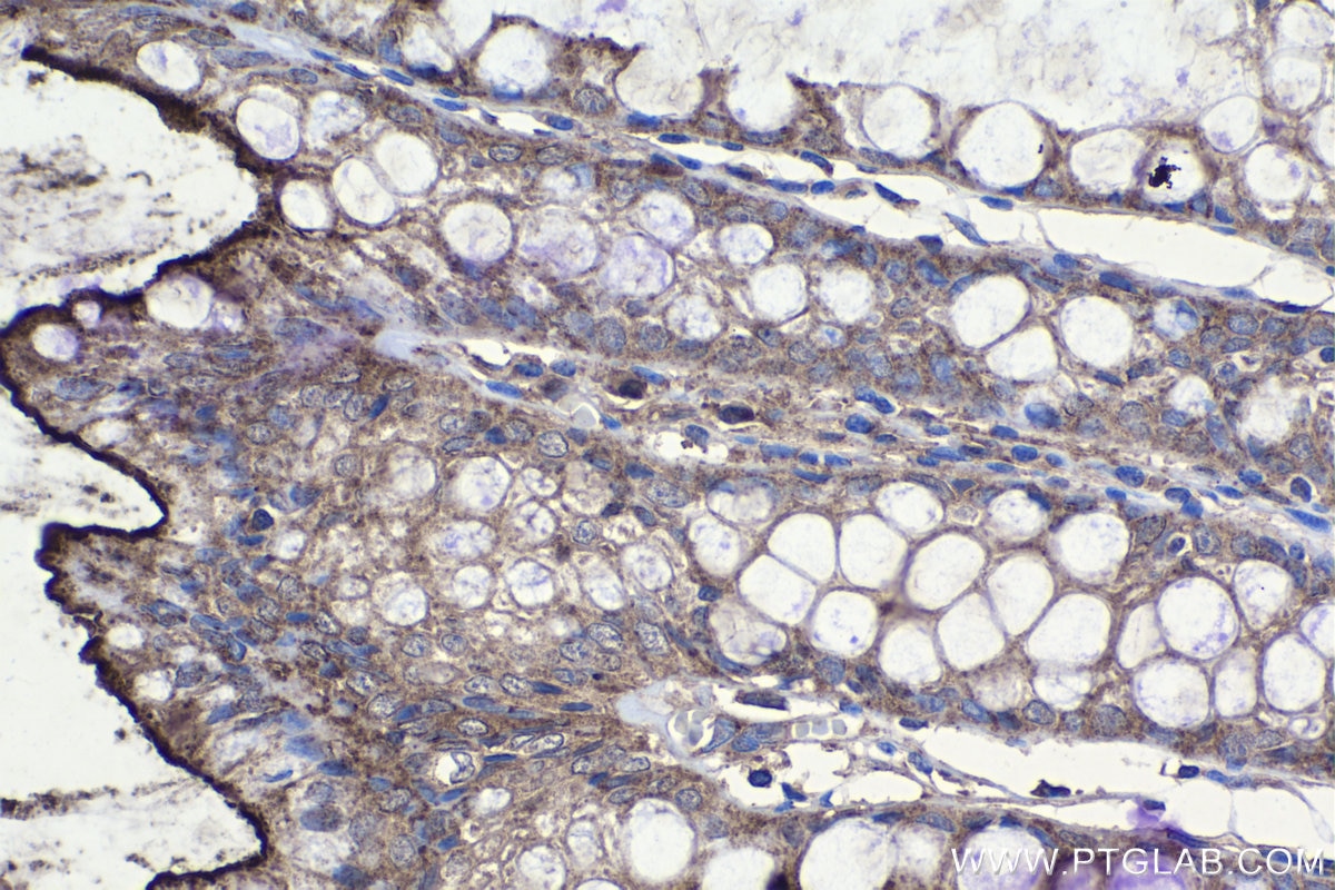 IHC staining of human colon using 66456-1-Ig