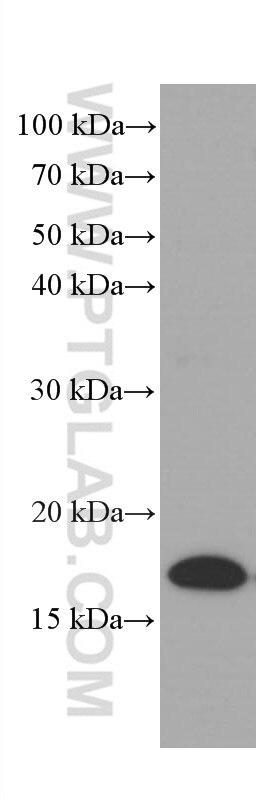 Western Blot (WB) analysis of human spleen tissue using Lysozyme Monoclonal antibody (66456-1-Ig)