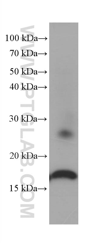 Western Blot (WB) analysis of rat spleen tissue using Lysozyme Monoclonal antibody (66456-1-Ig)