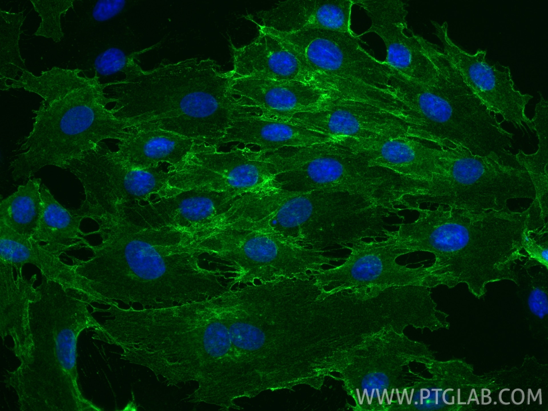 Immunofluorescence (IF) / fluorescent staining of H9C2 cells using M-cadherin Recombinant antibody (84440-5-RR)