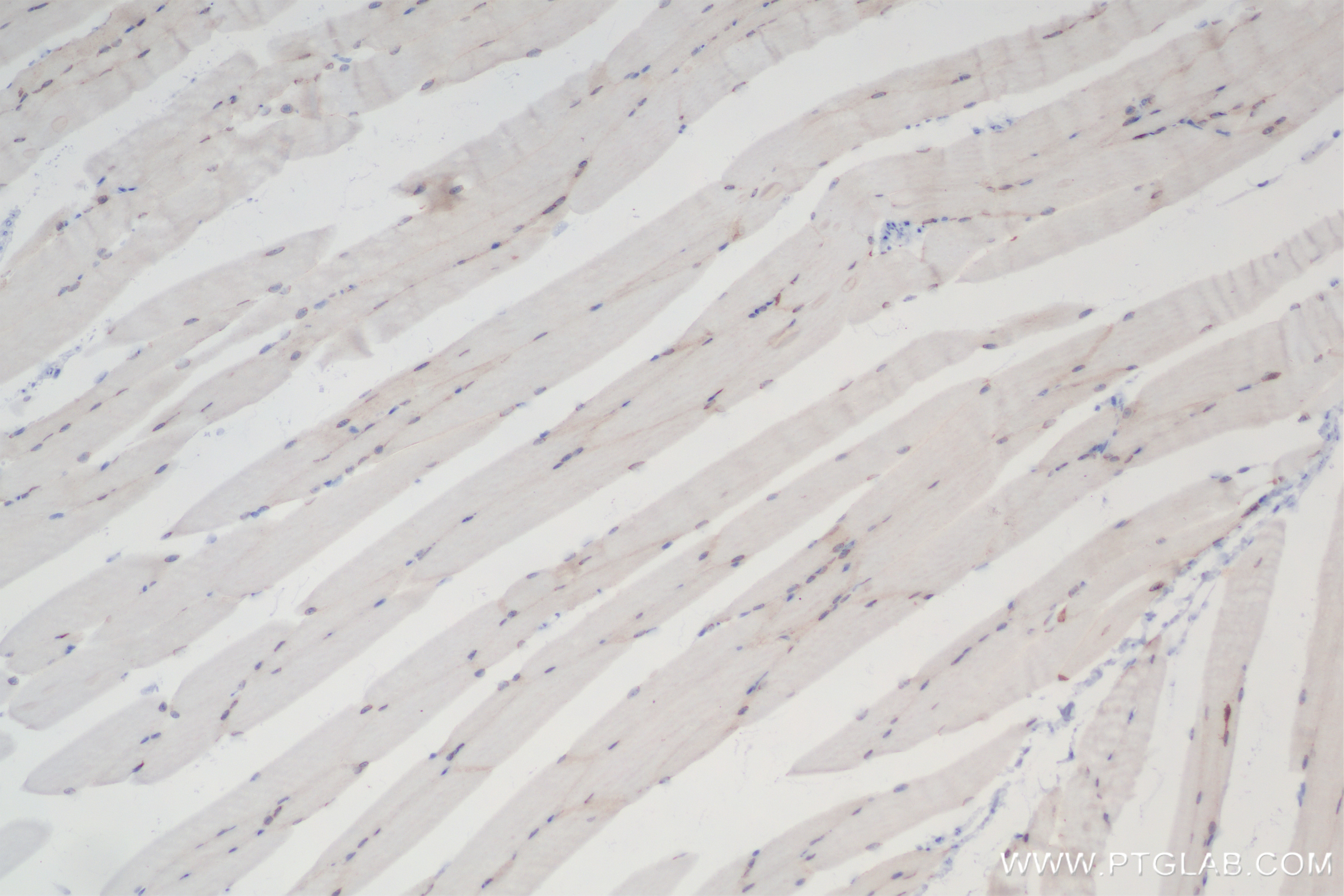 Immunohistochemistry (IHC) staining of mouse skeletal muscle tissue using M-cadherin Recombinant antibody (84440-5-RR)