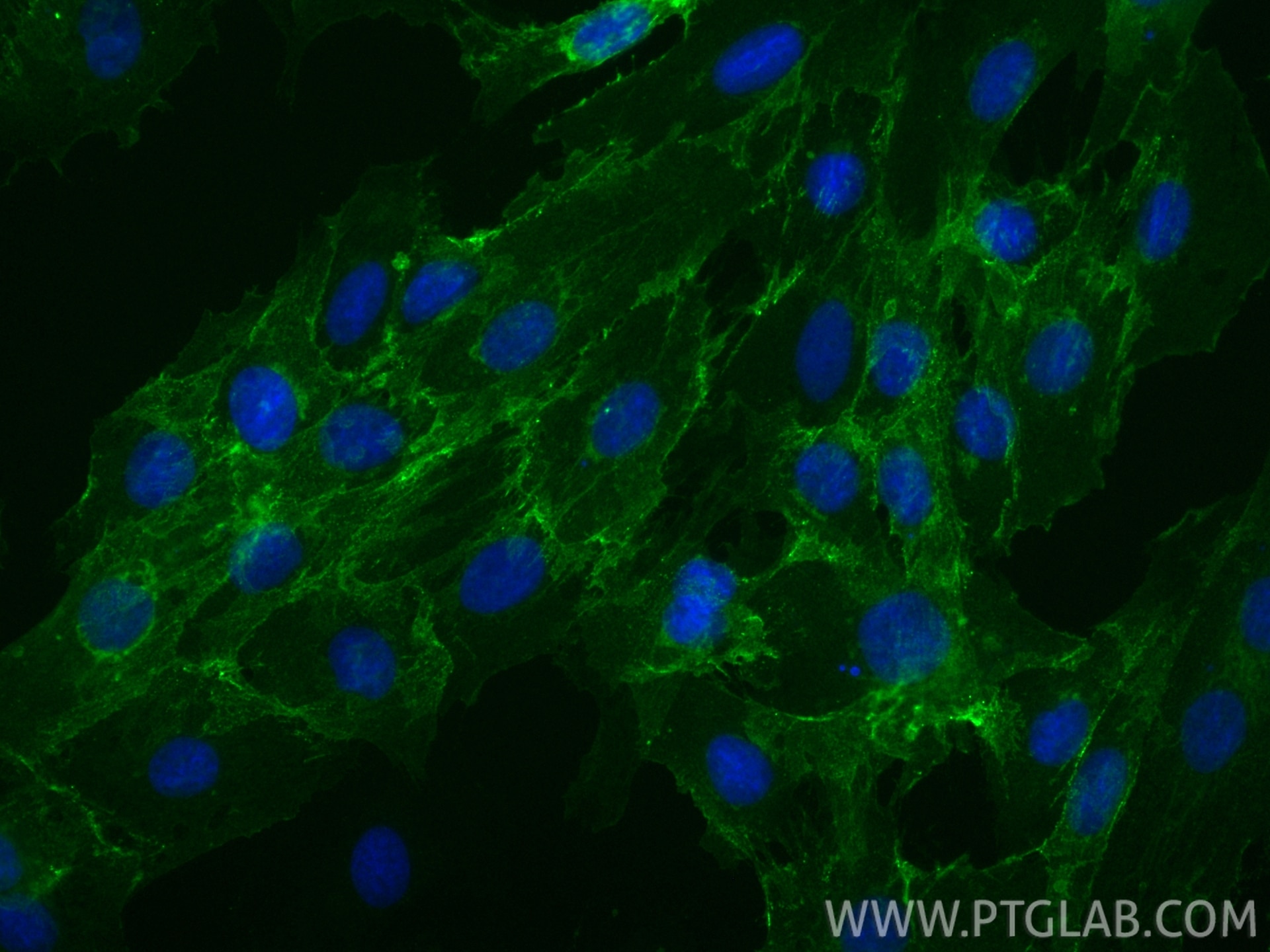 Immunofluorescence (IF) / fluorescent staining of H9C2 cells using CoraLite® Plus 488-conjugated M-cadherin Recombina (CL488-84440-5)