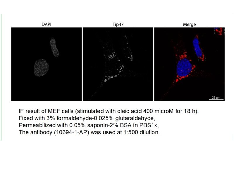Immunofluorescence (IF) / fluorescent staining of MEF cells using TIP47 Polyclonal antibody (10694-1-AP)