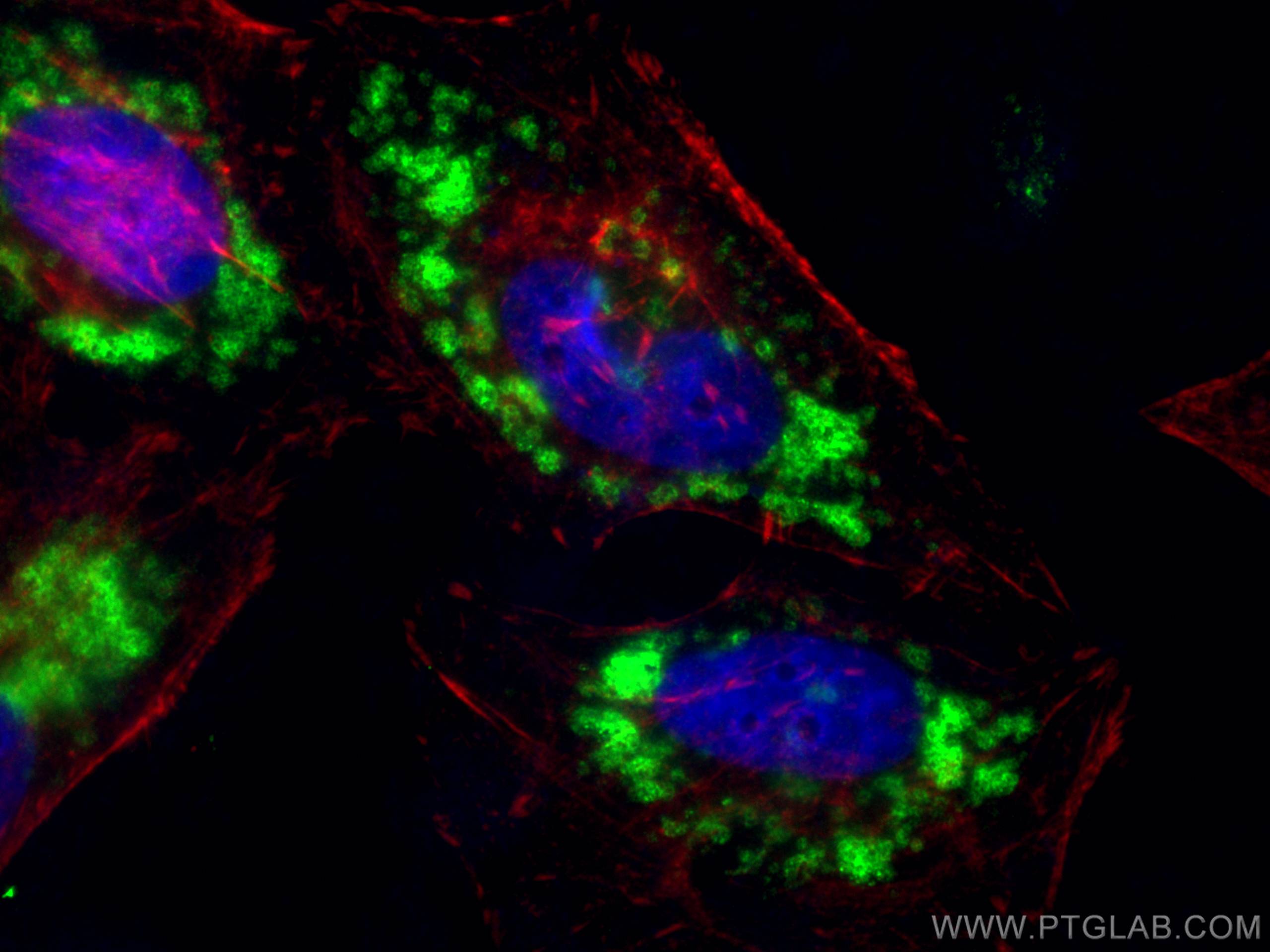 Immunofluorescence (IF) / fluorescent staining of HeLa cells using TIP47 Polyclonal antibody (10694-1-AP)