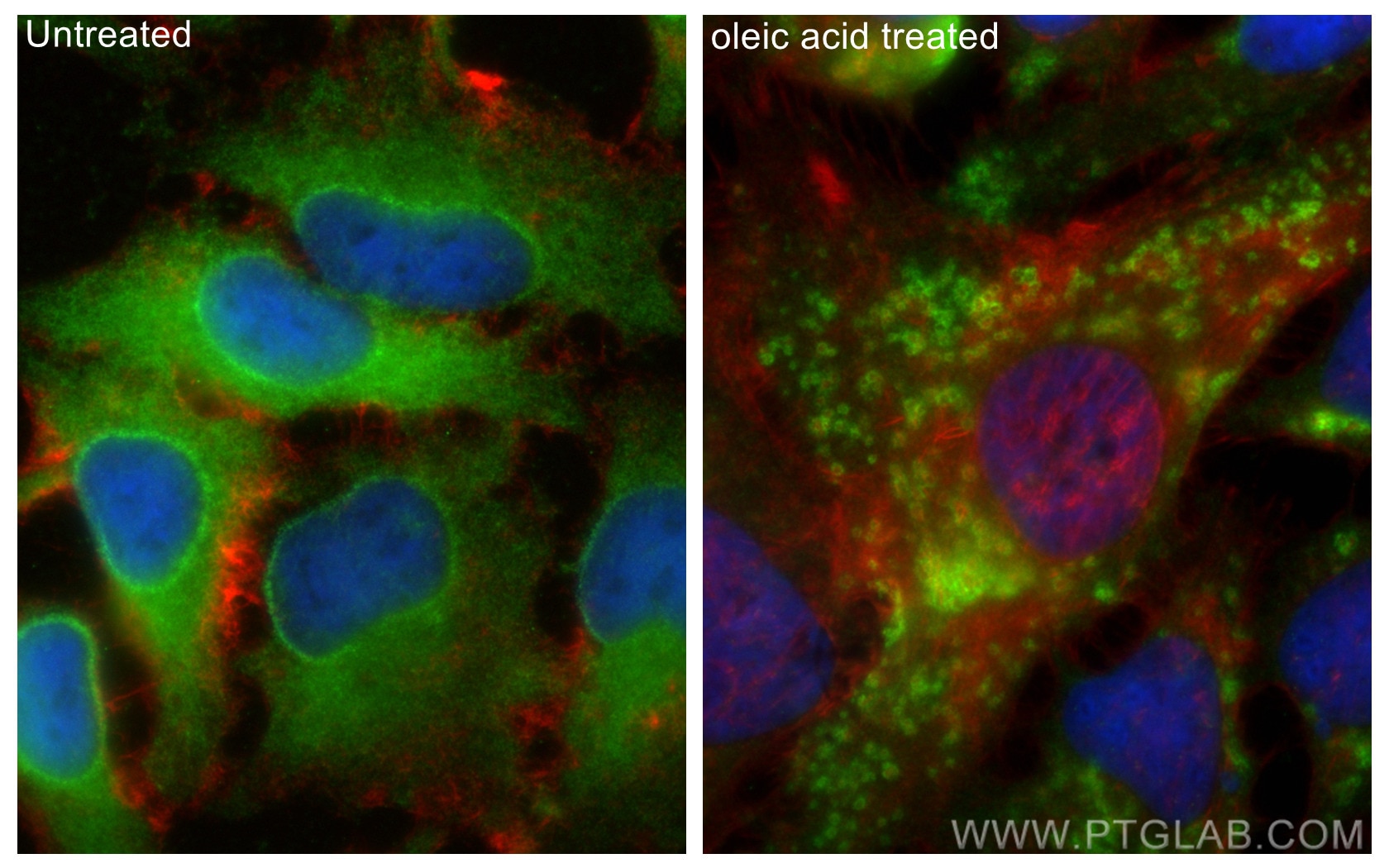 Immunofluorescence (IF) / fluorescent staining of HeLa cells using TIP47 Polyclonal antibody (10694-1-AP)