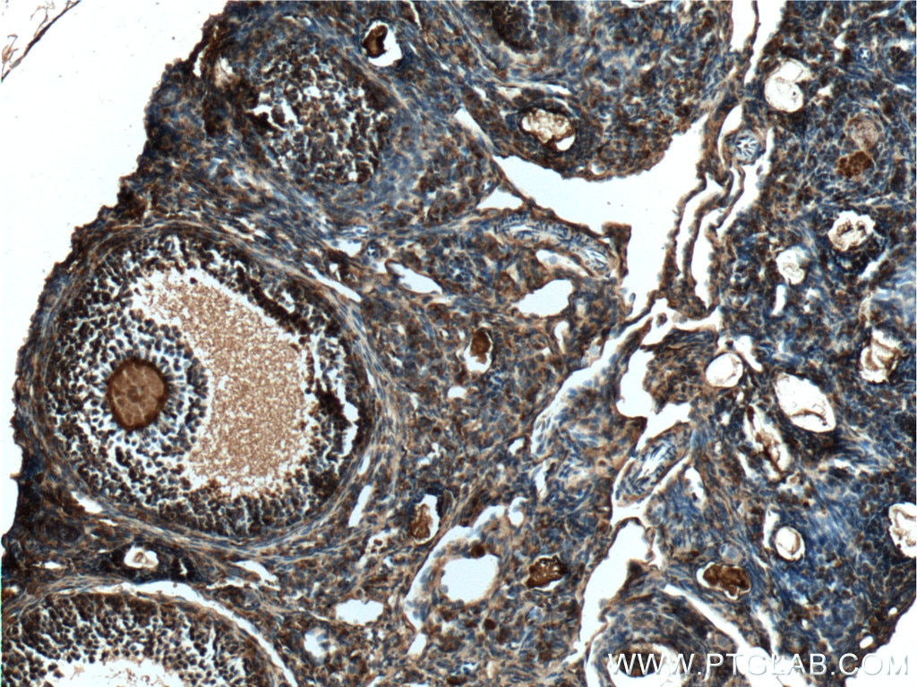 Immunohistochemistry (IHC) staining of mouse ovary tissue using TIP47 Polyclonal antibody (10694-1-AP)
