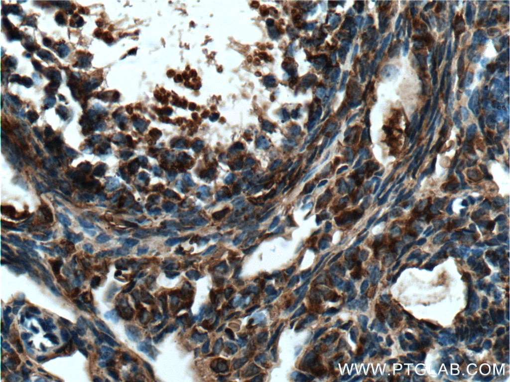 Immunohistochemistry (IHC) staining of mouse ovary tissue using TIP47 Polyclonal antibody (10694-1-AP)