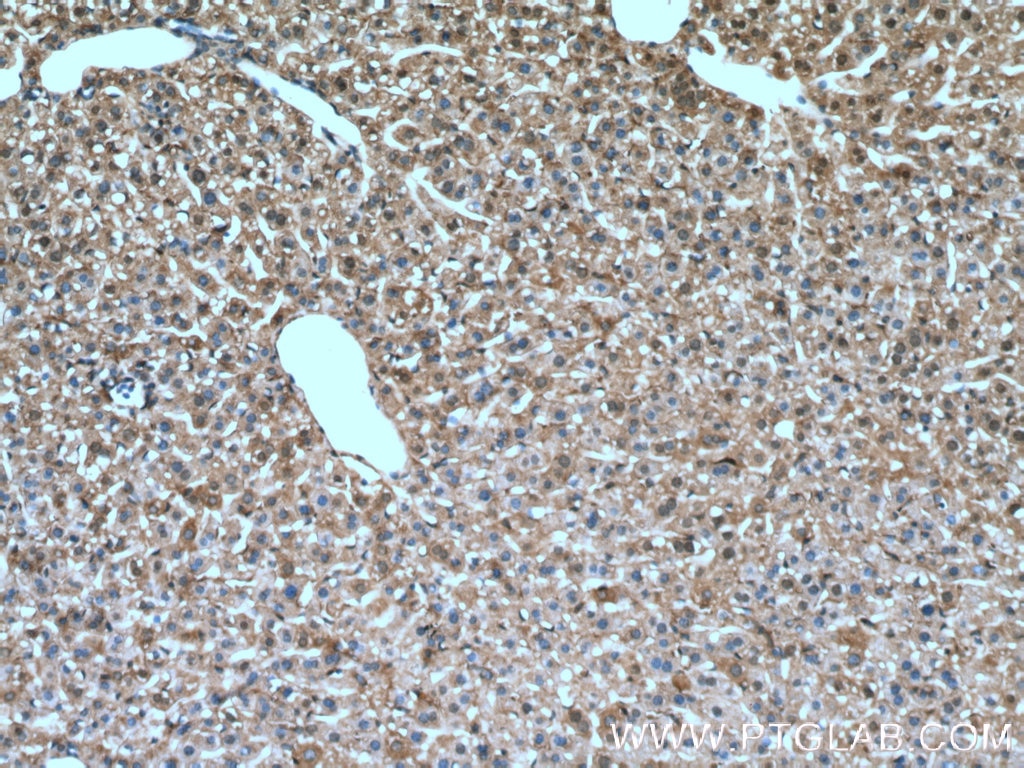 Immunohistochemistry (IHC) staining of mouse liver tissue using TIP47 Polyclonal antibody (10694-1-AP)